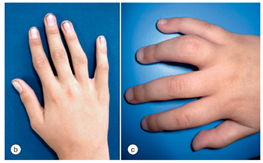 Clinpract 14 00168 i004