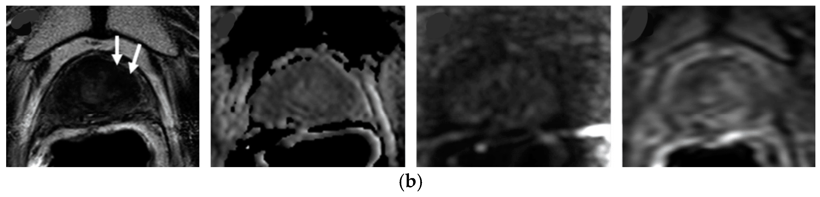 Clinpract 15 00004 g002b Clinpract 15 00004 g002b