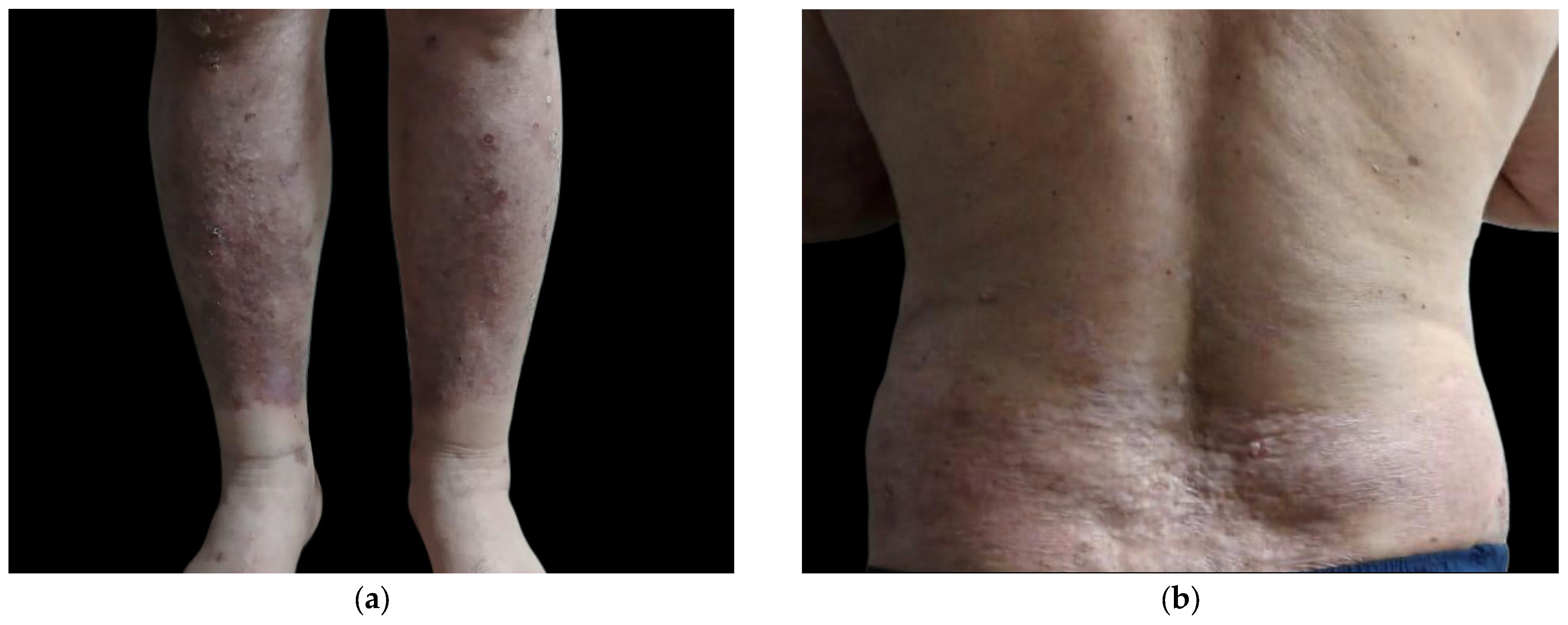 Clinpract 15 00091 g006 Clinpract 15 00091 g006