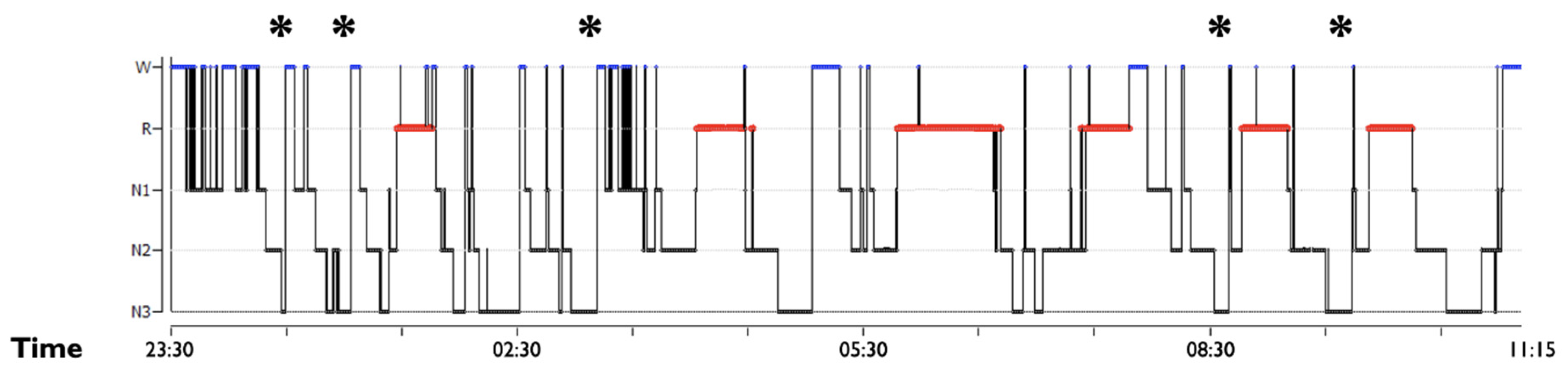 Clockssleep 03 00004 g002 Clockssleep 03 00004 g002