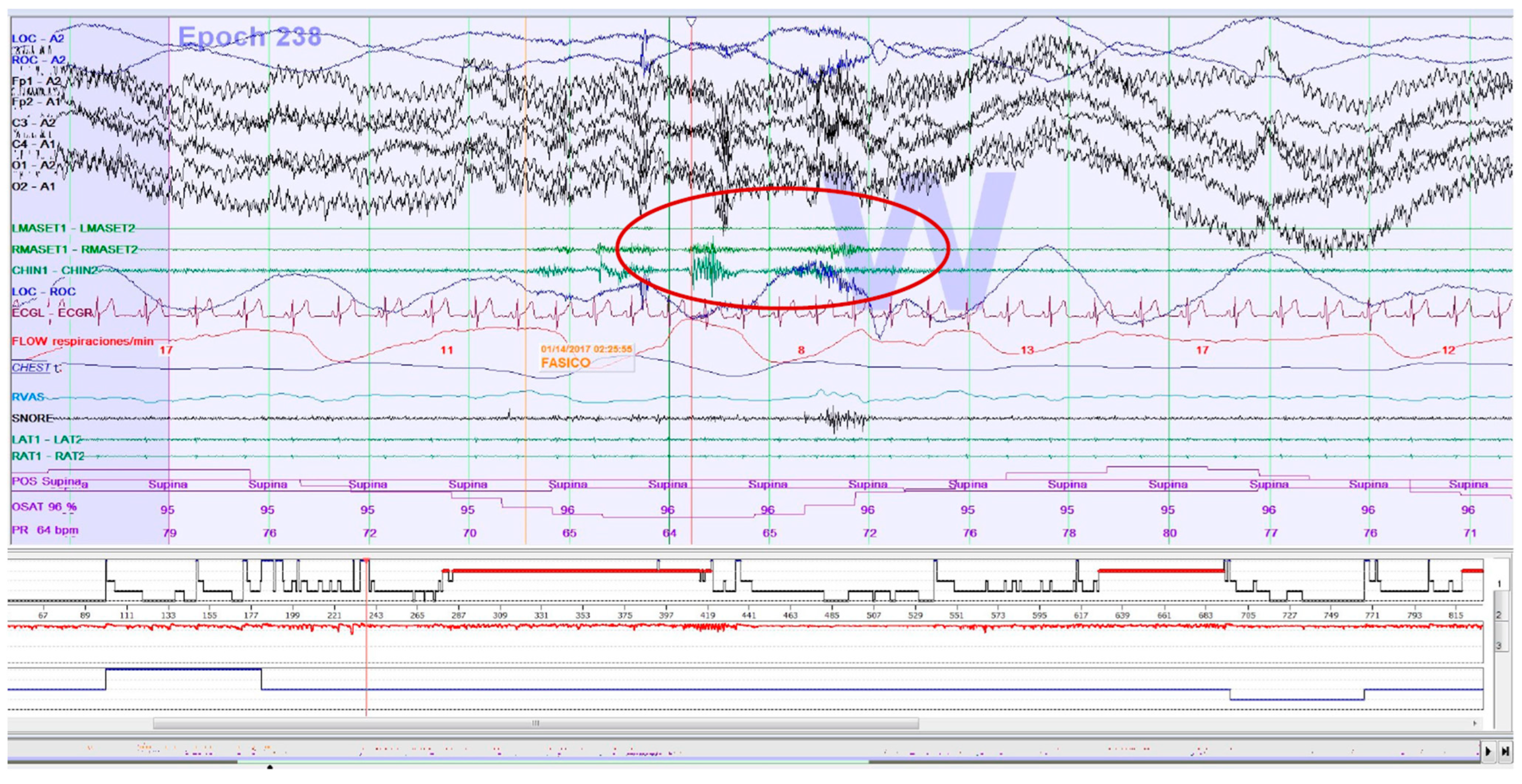 Clockssleep 05 00047 g002