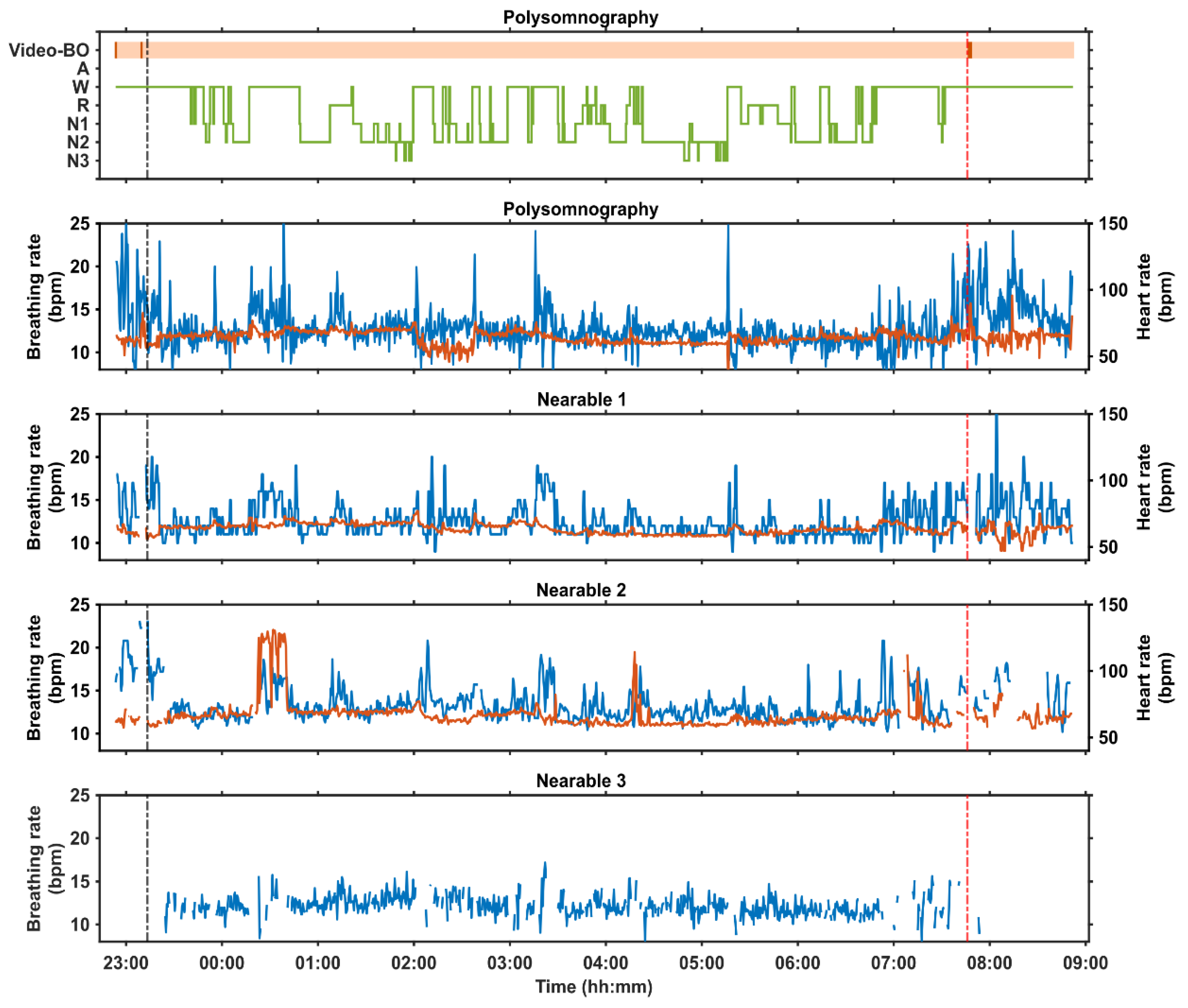 Clockssleep 06 00010 g005 Clockssleep 06 00010 g005