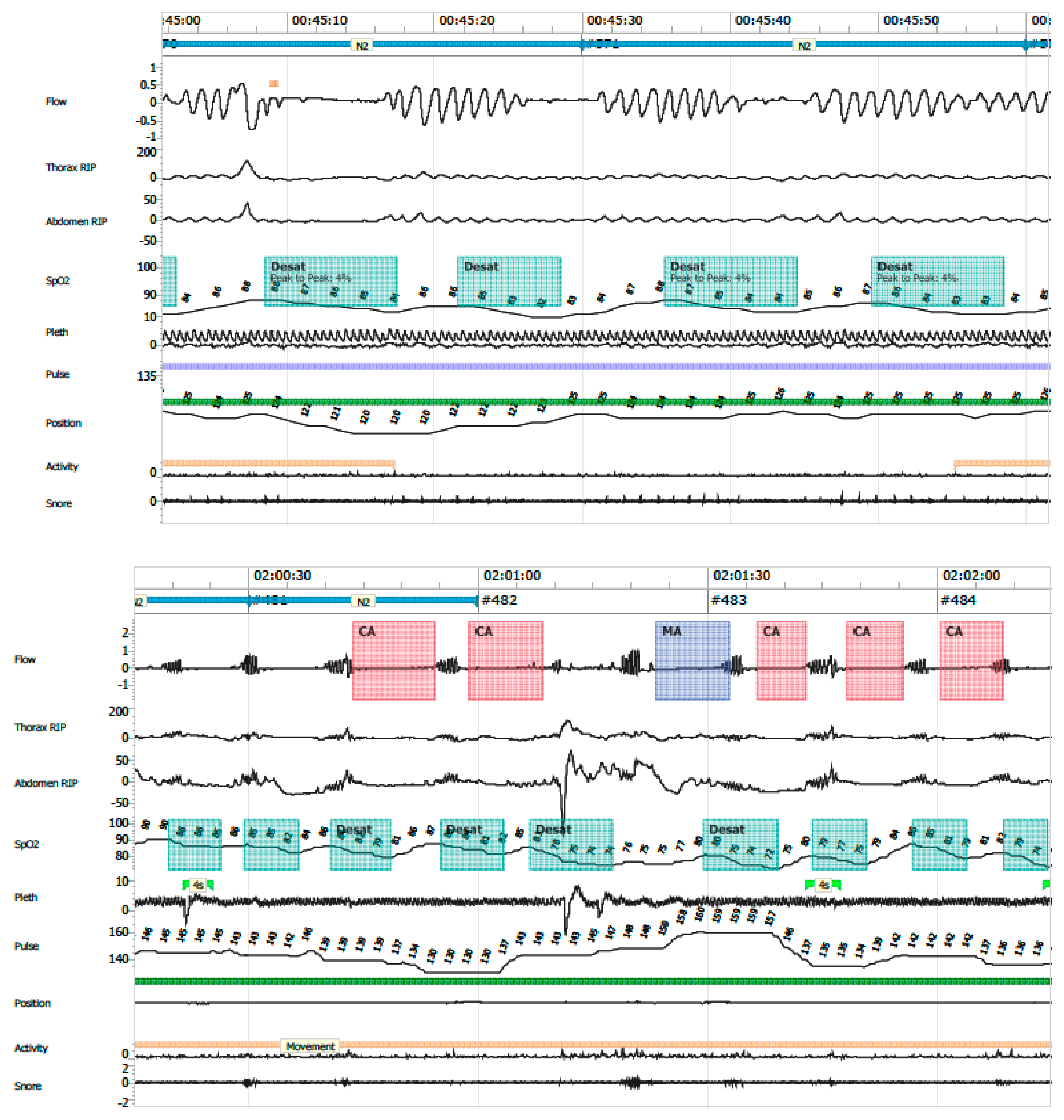 Clockssleep 07 00042 g008