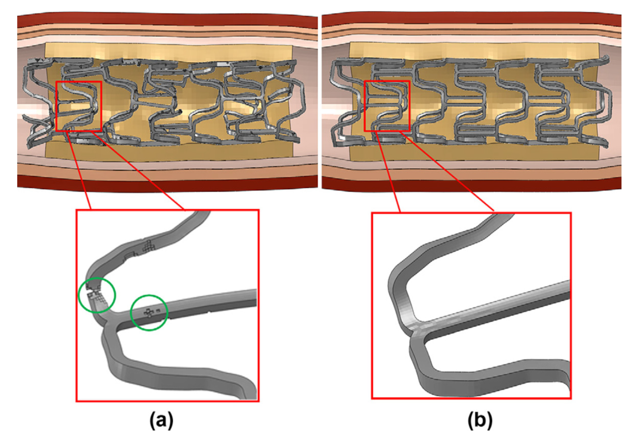 Cmd 01 00011 g006 Cmd 01 00011 g006
