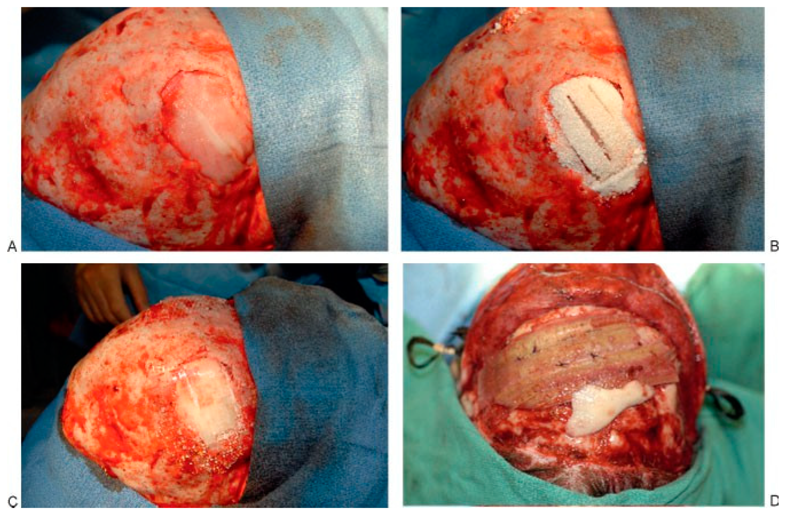 Cmtr 02 00012 g003 Cmtr 02 00012 g003