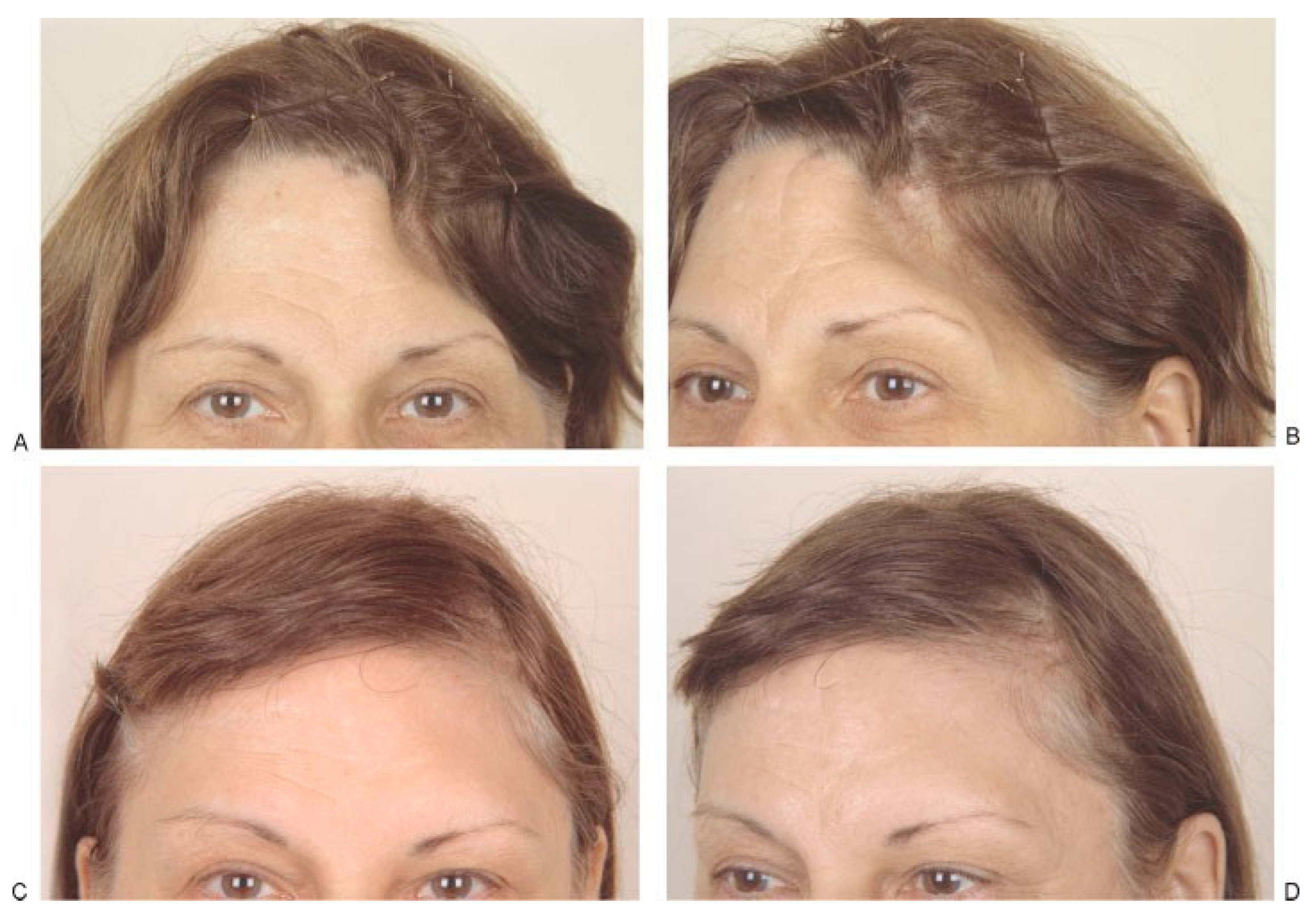 Cmtr 02 00015 g003 Cmtr 02 00015 g003