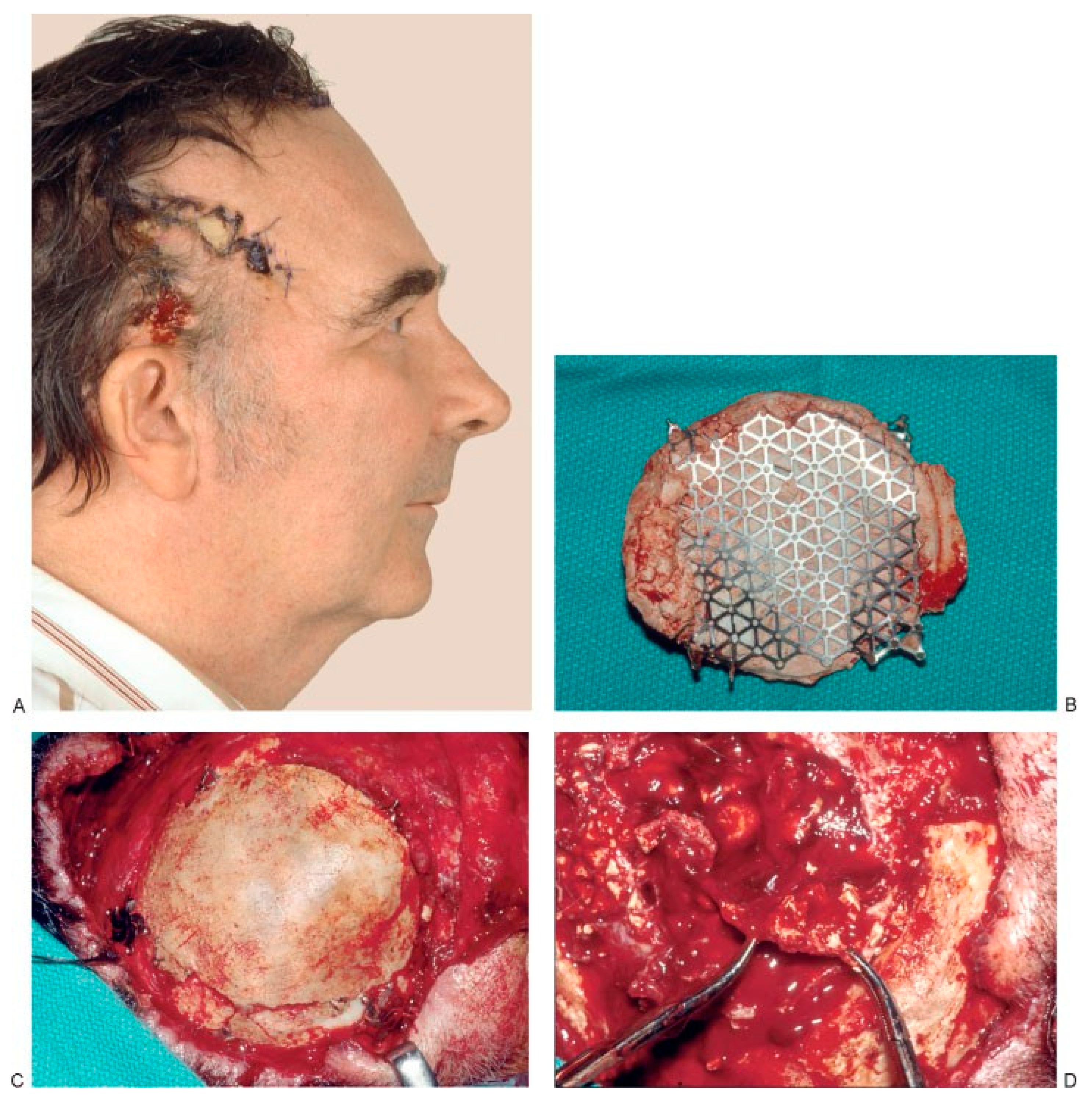 Cmtr 02 00015 g004a Cmtr 02 00015 g004a