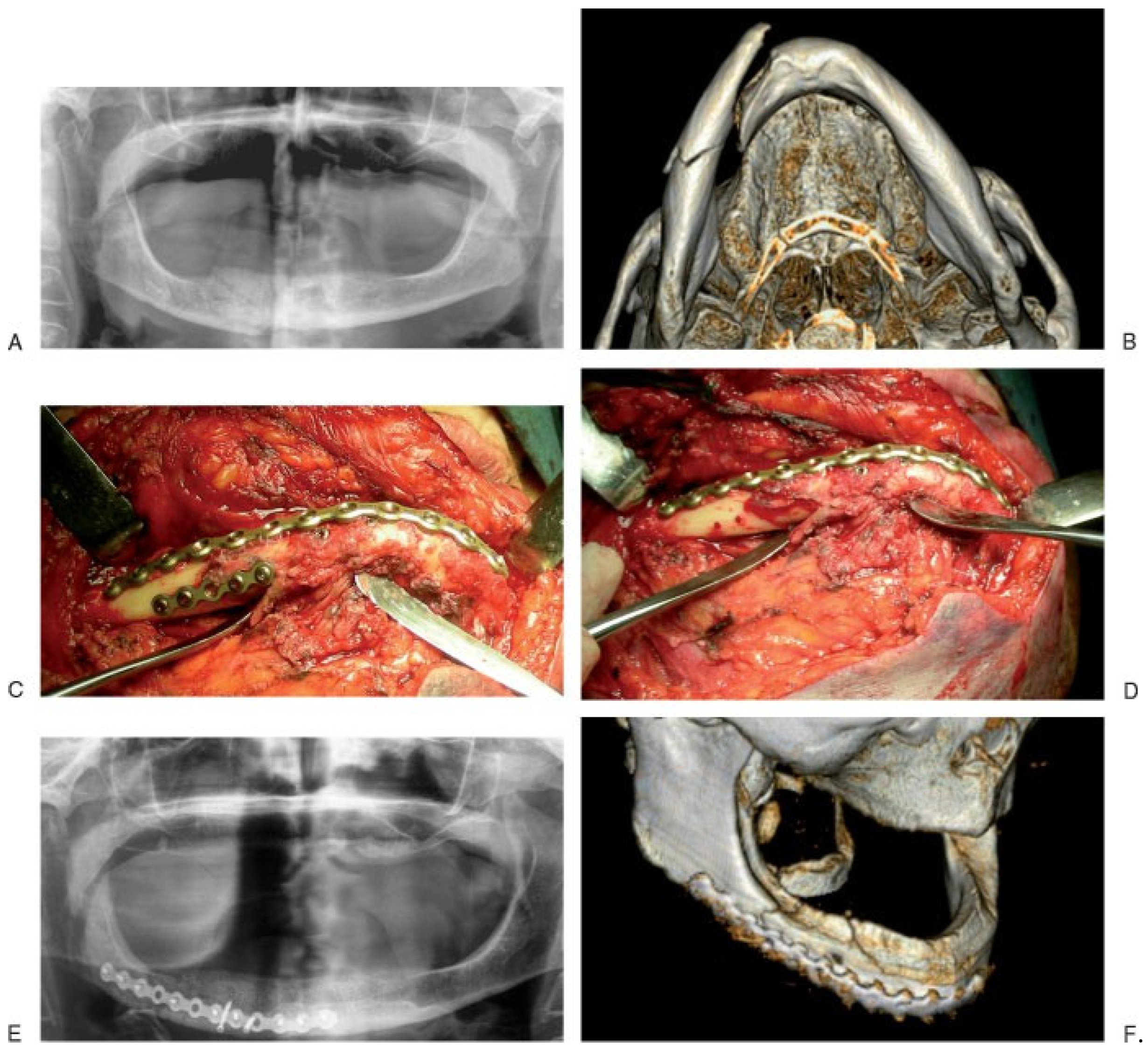 Cmtr 05 v5i2f65 g003