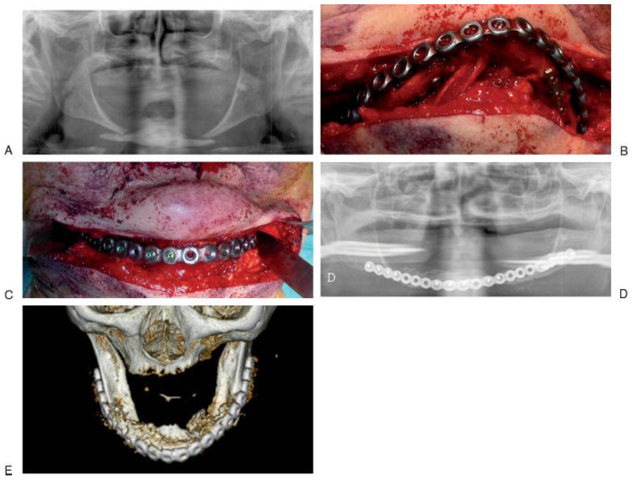 Cmtr 05 v5i2f65 g005