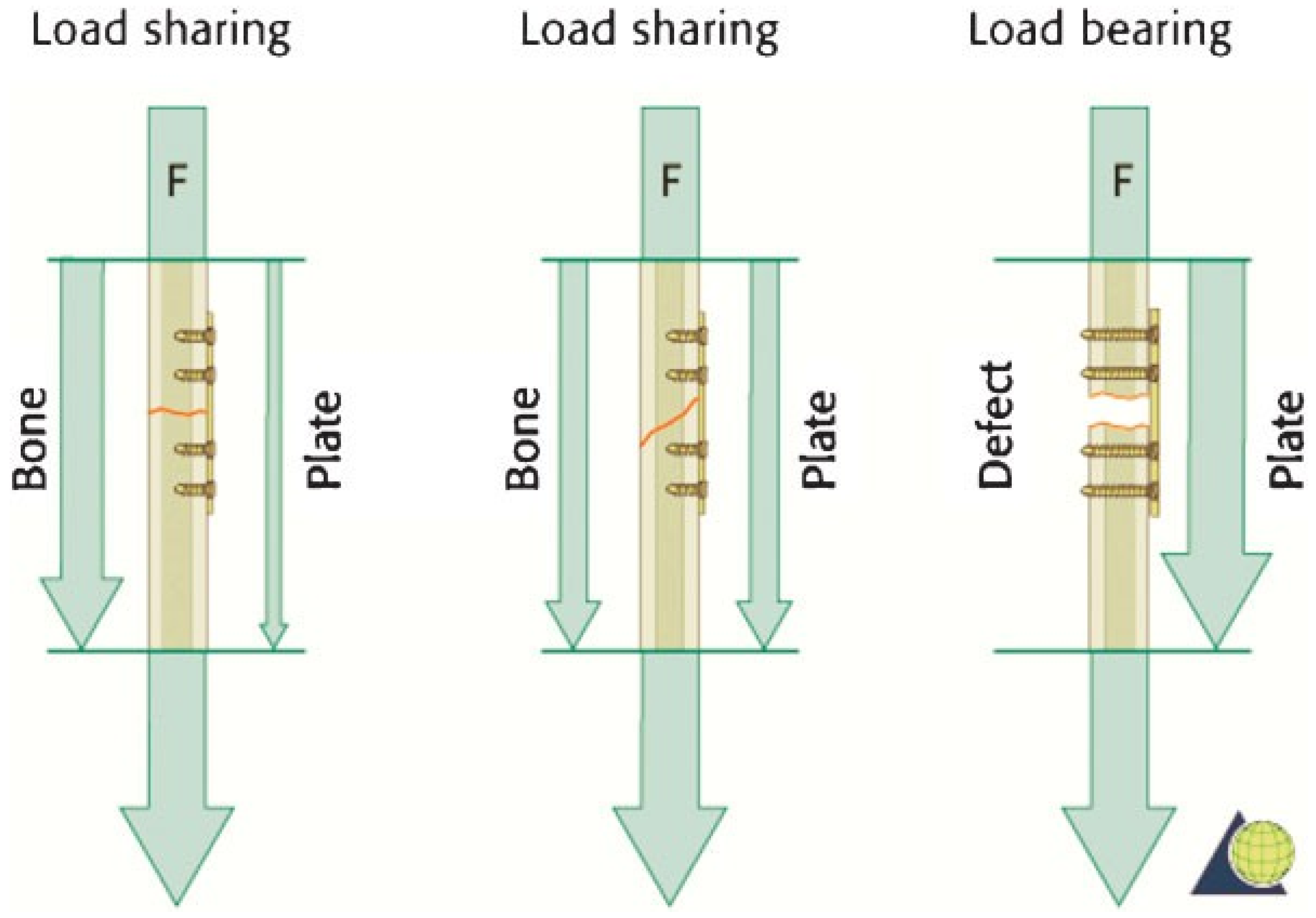 Cmtr 05 v5i2f65 g006