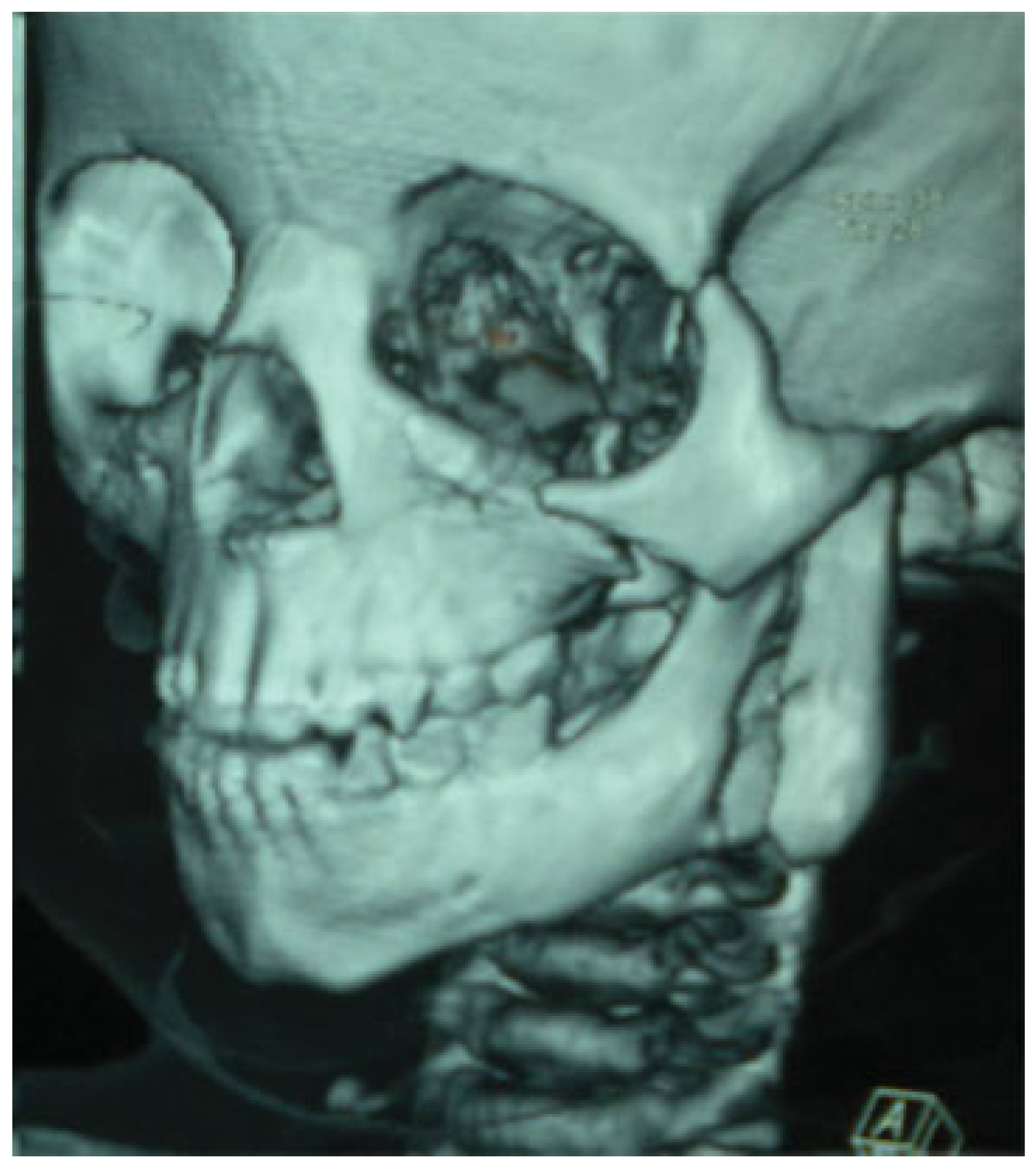 Cmtr 06 00022 g005 Cmtr 06 00022 g005