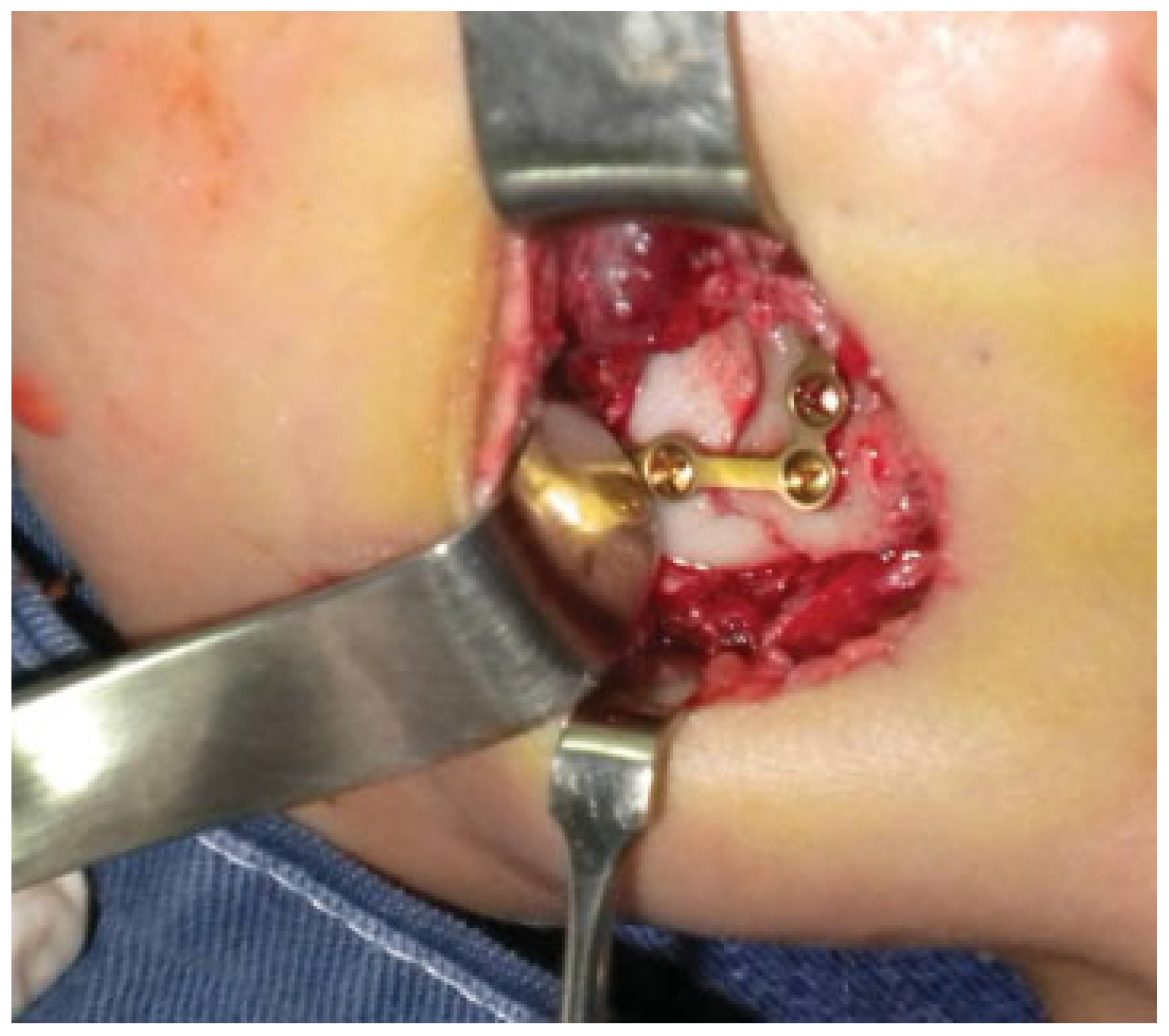 Cmtr 06 00022 g008 Cmtr 06 00022 g008