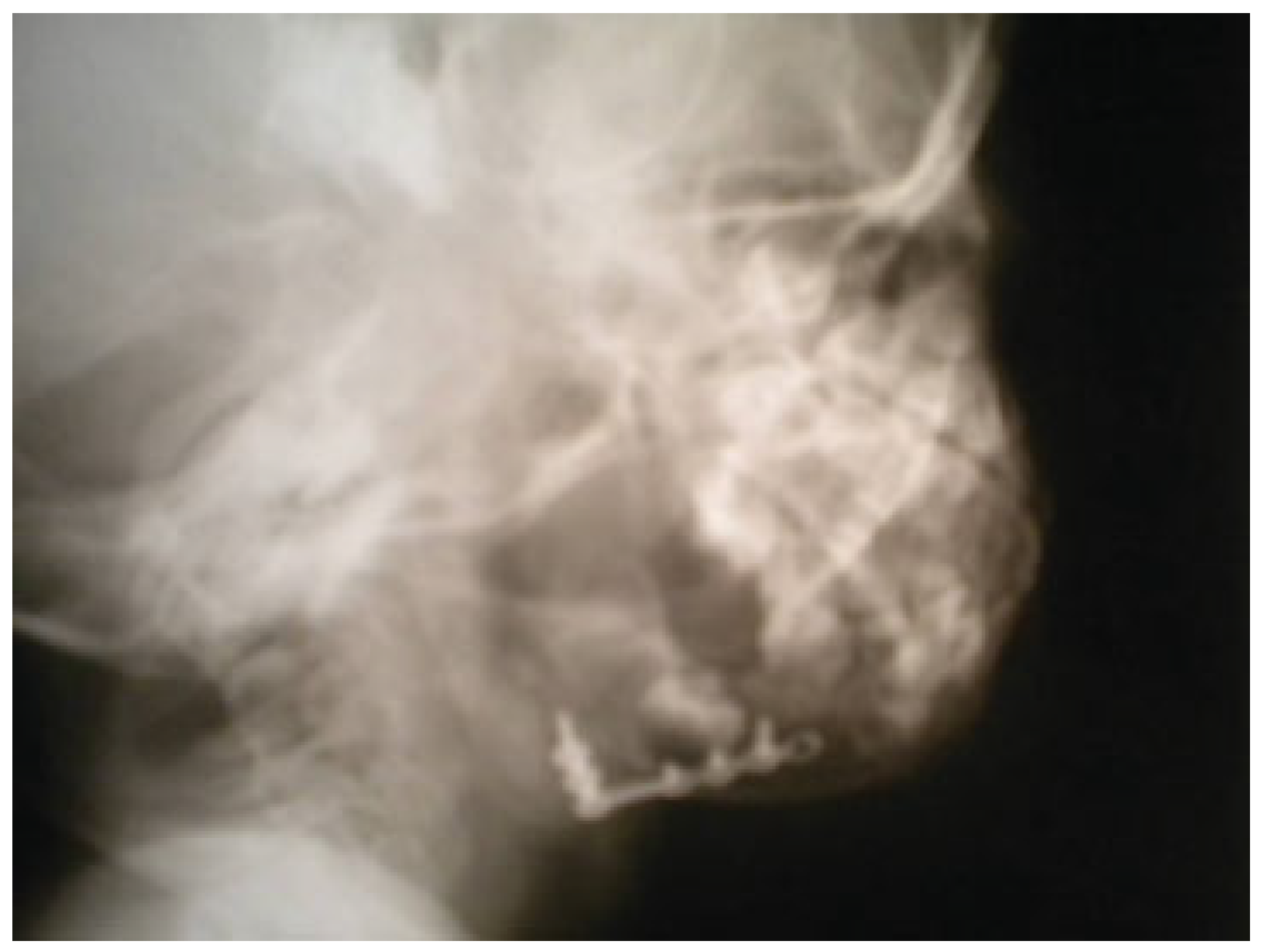 Cmtr 06 00022 g010 Cmtr 06 00022 g010