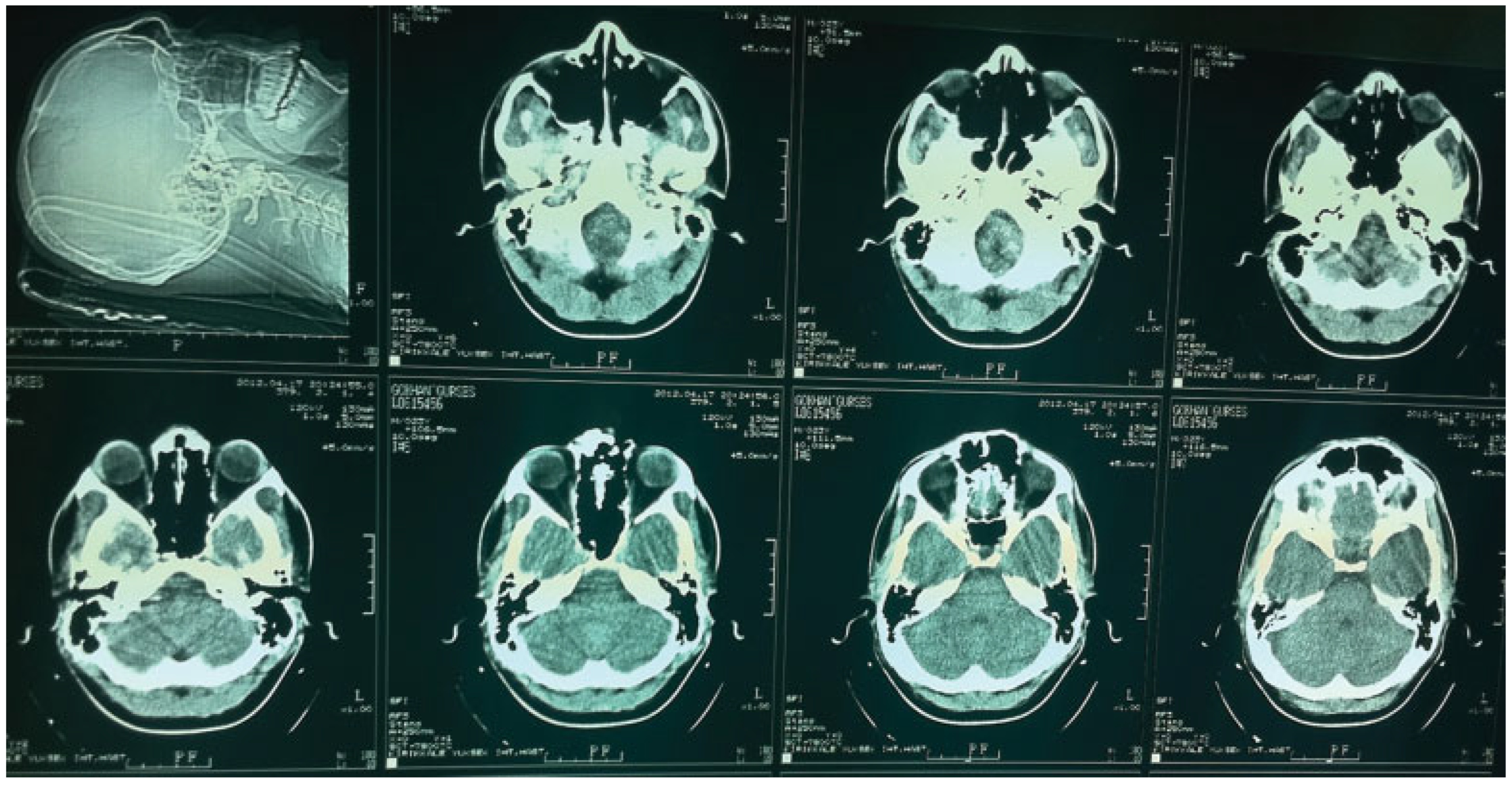 Cmtr 07 00026 g001 Cmtr 07 00026 g001