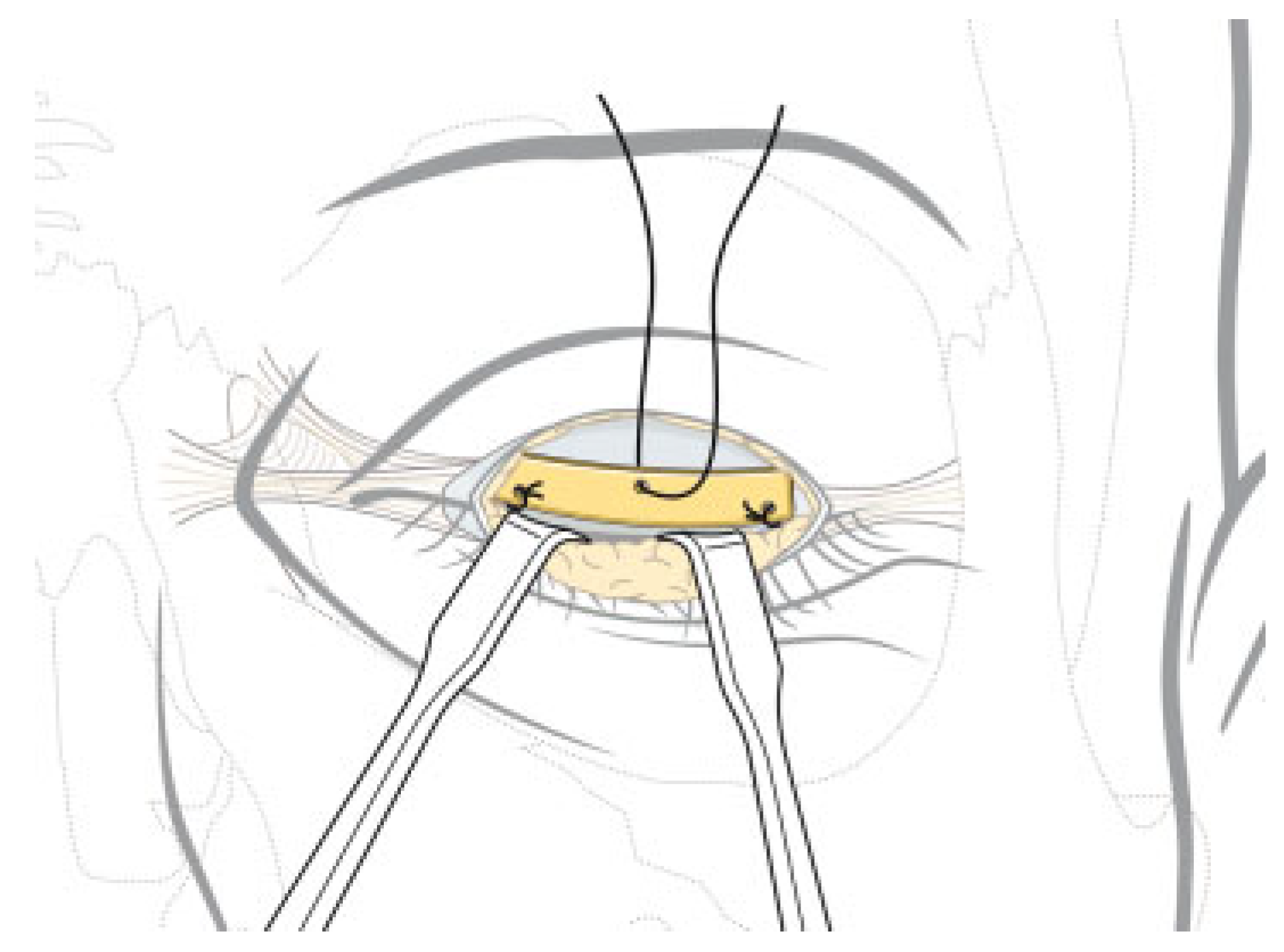 Cmtr 08 i1f1 g003 Cmtr 08 i1f1 g003