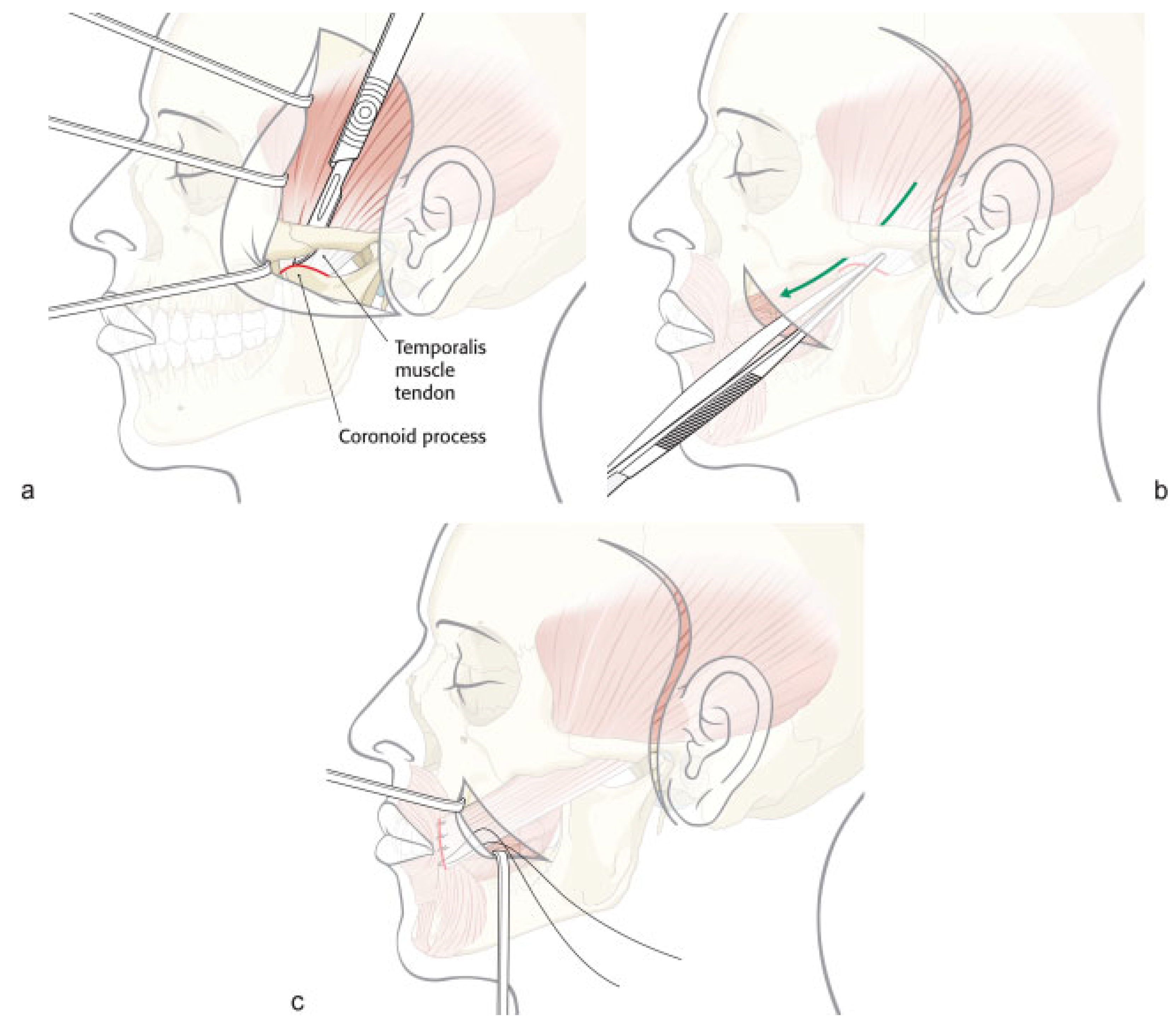 Cmtr 08 i1f1 g006 Cmtr 08 i1f1 g006