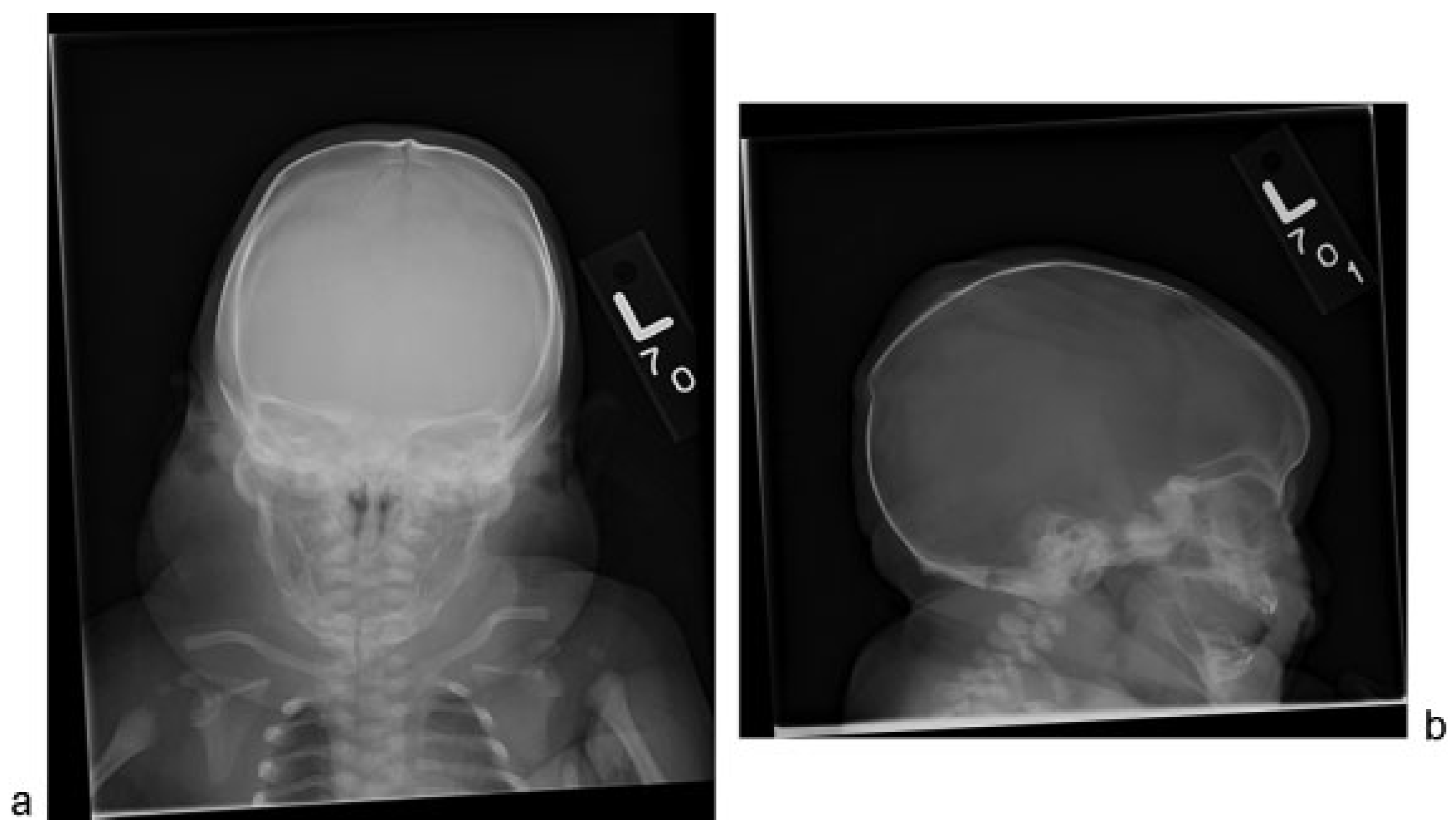 Cmtr 08 i2f132 g001 Cmtr 08 i2f132 g001