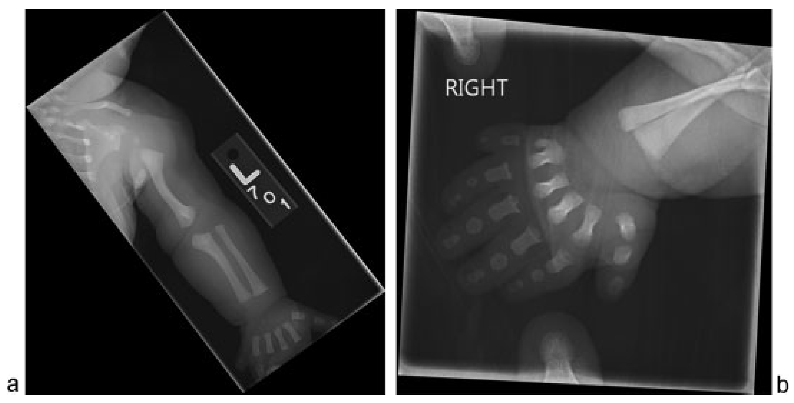 Cmtr 08 i2f132 g002 Cmtr 08 i2f132 g002