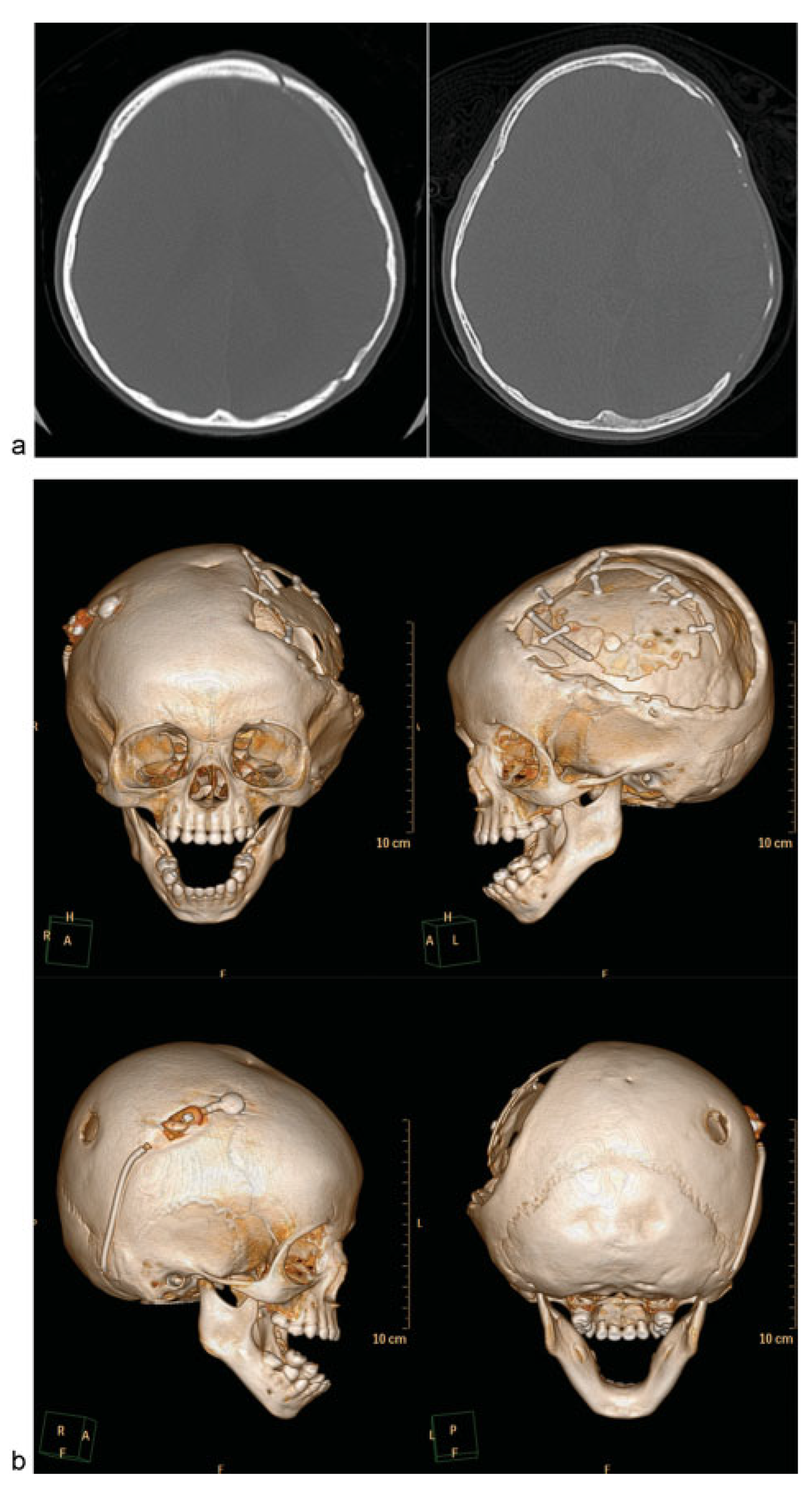 Cmtr 08 i2f159 g001a