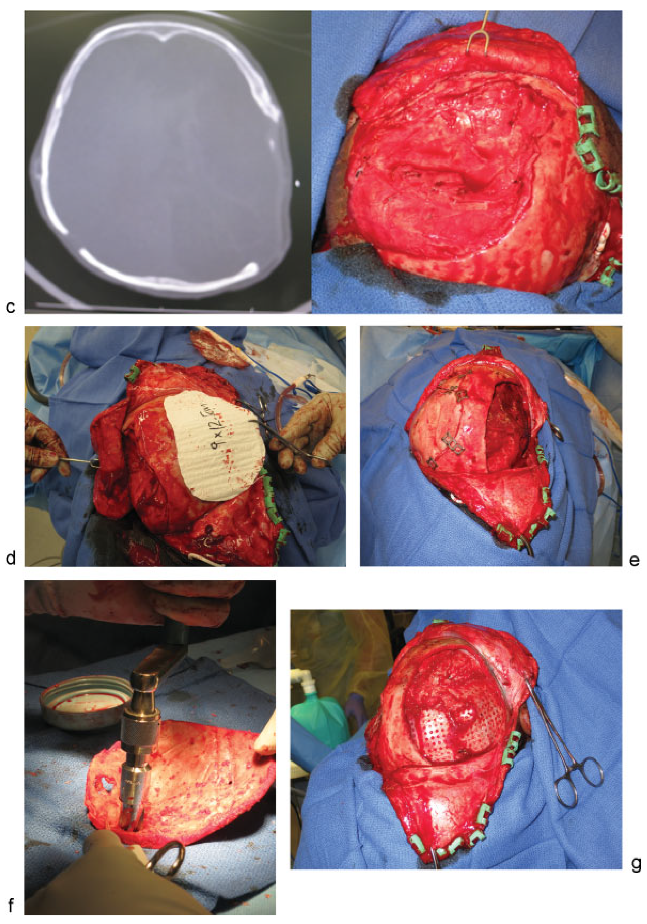 Cmtr 08 i2f159 g001b