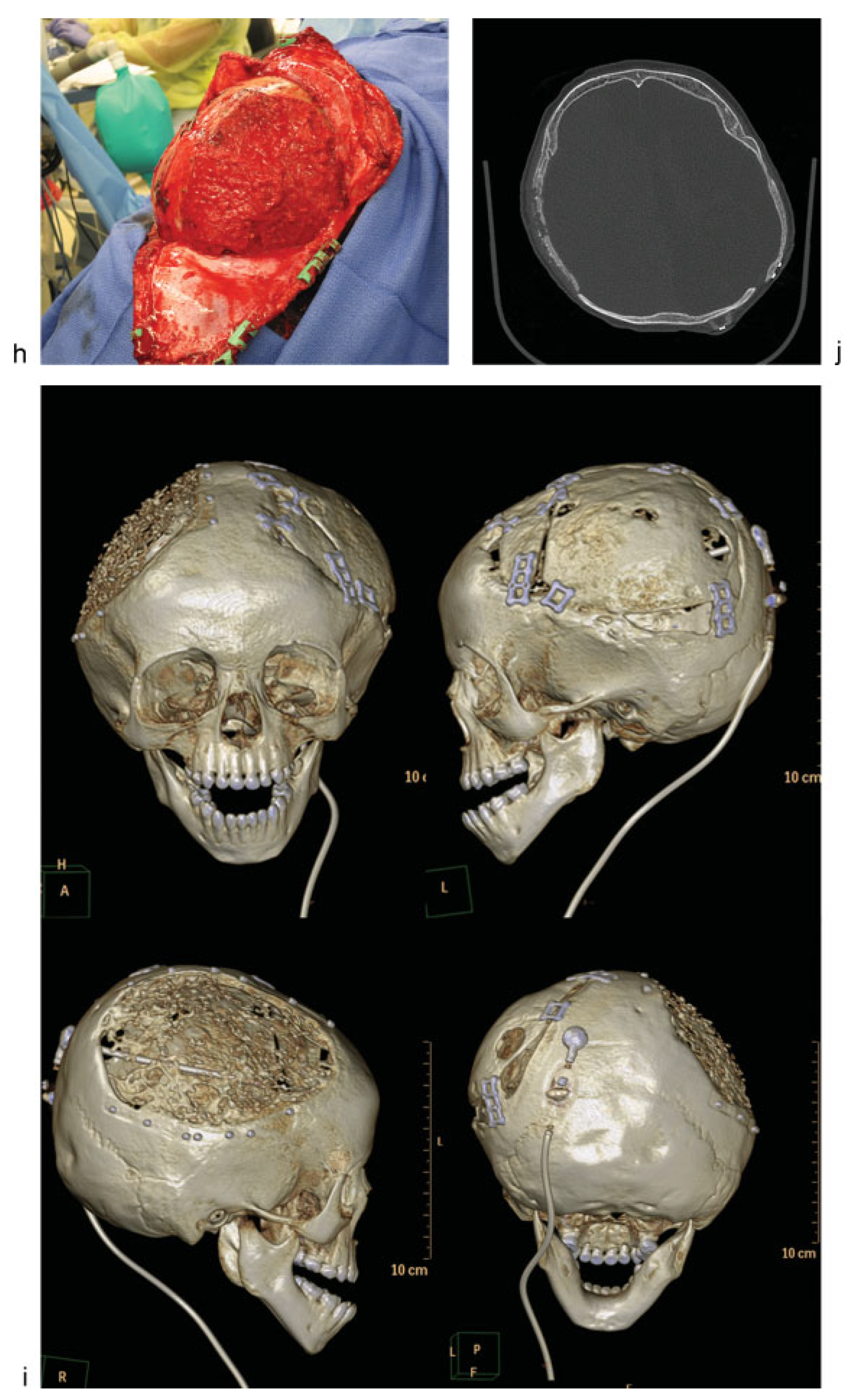 Cmtr 08 i2f159 g001c