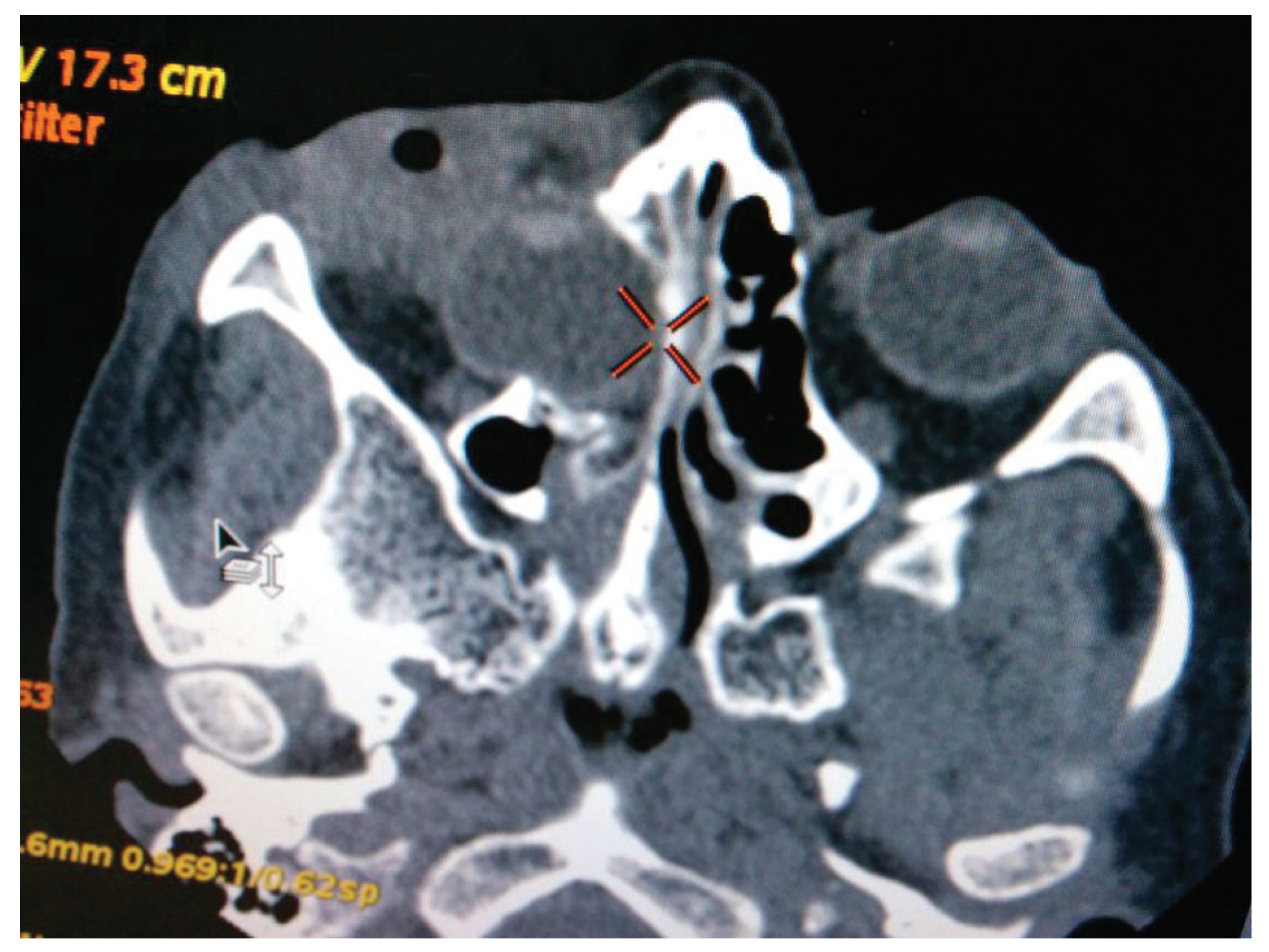 Cmtr 10 00014 g003 Cmtr 10 00014 g003