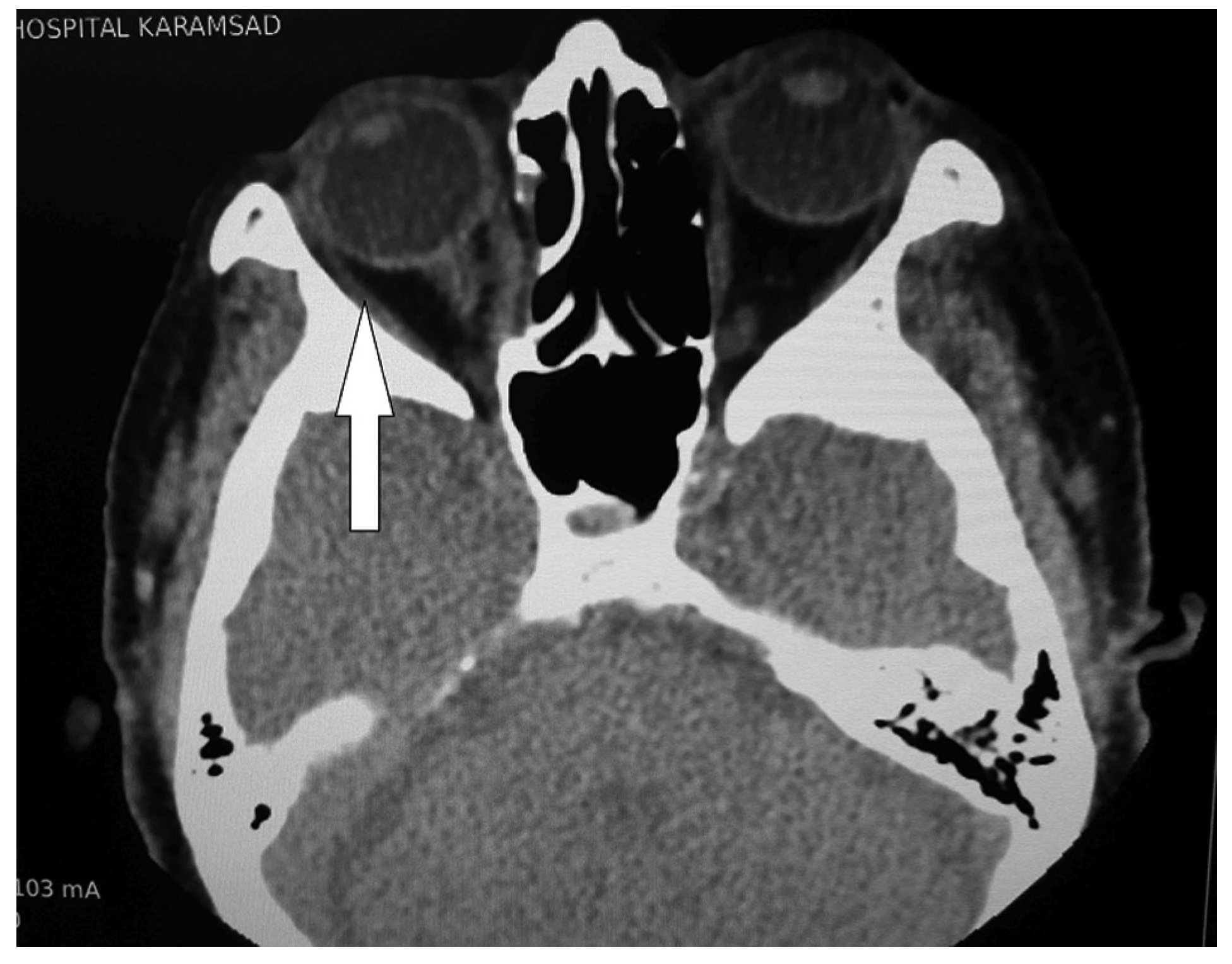 Cmtr 10 00014 g007 Cmtr 10 00014 g007