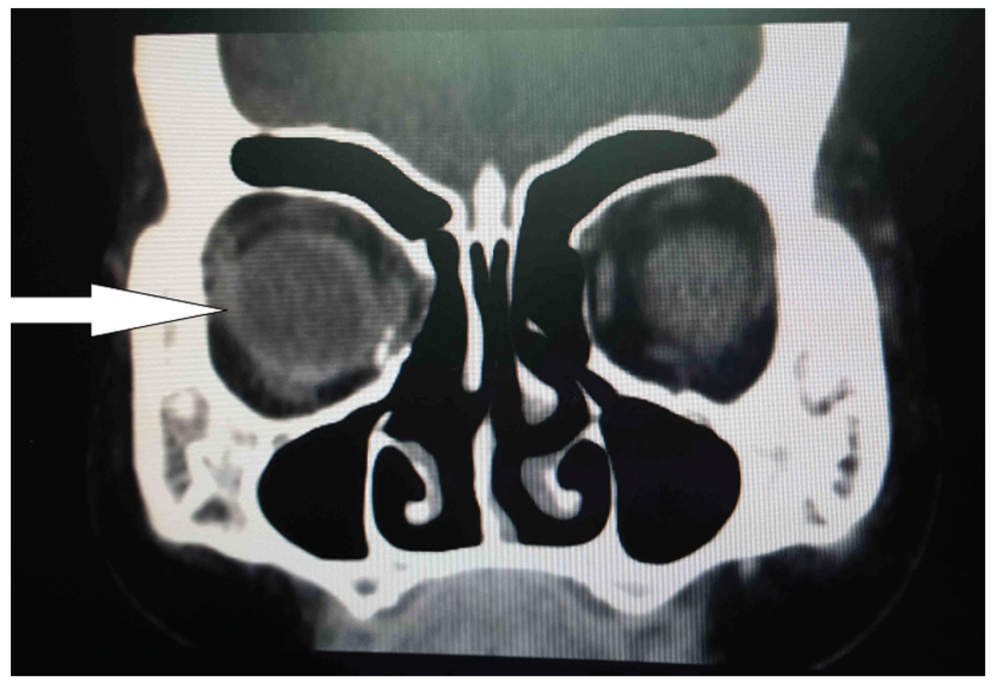 Cmtr 10 00014 g008 Cmtr 10 00014 g008