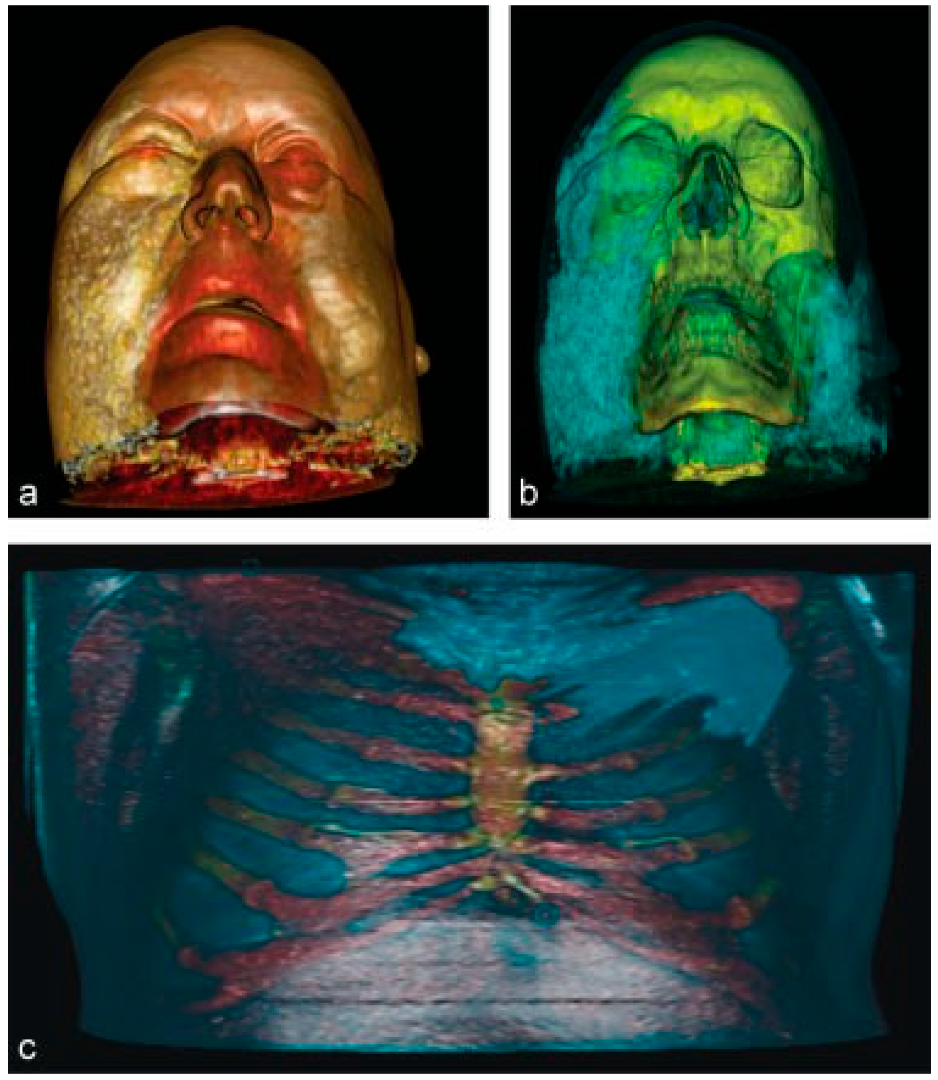 Cmtr 12 00010 g004 Cmtr 12 00010 g004