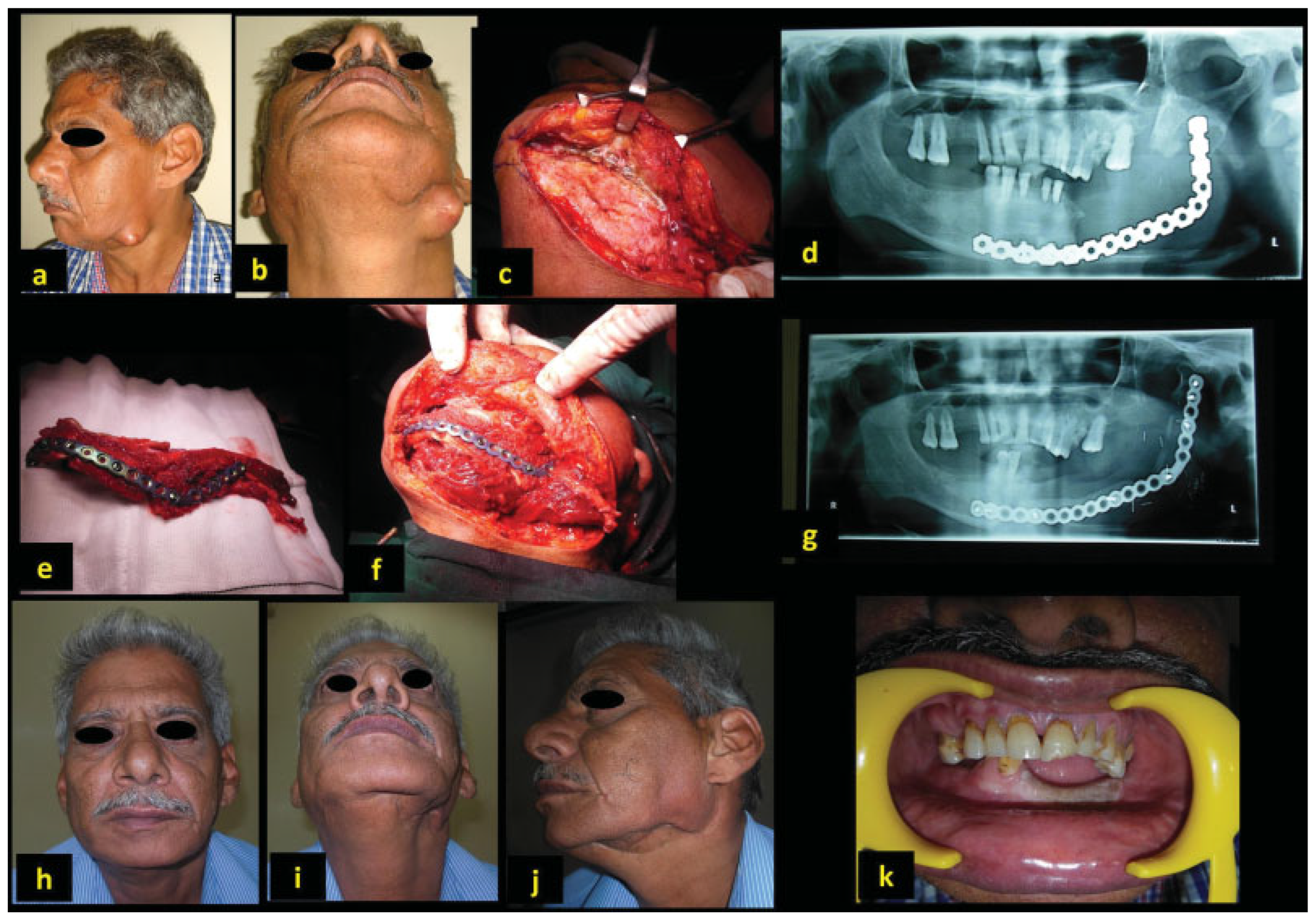 Cmtr 12 00039 g004 Cmtr 12 00039 g004