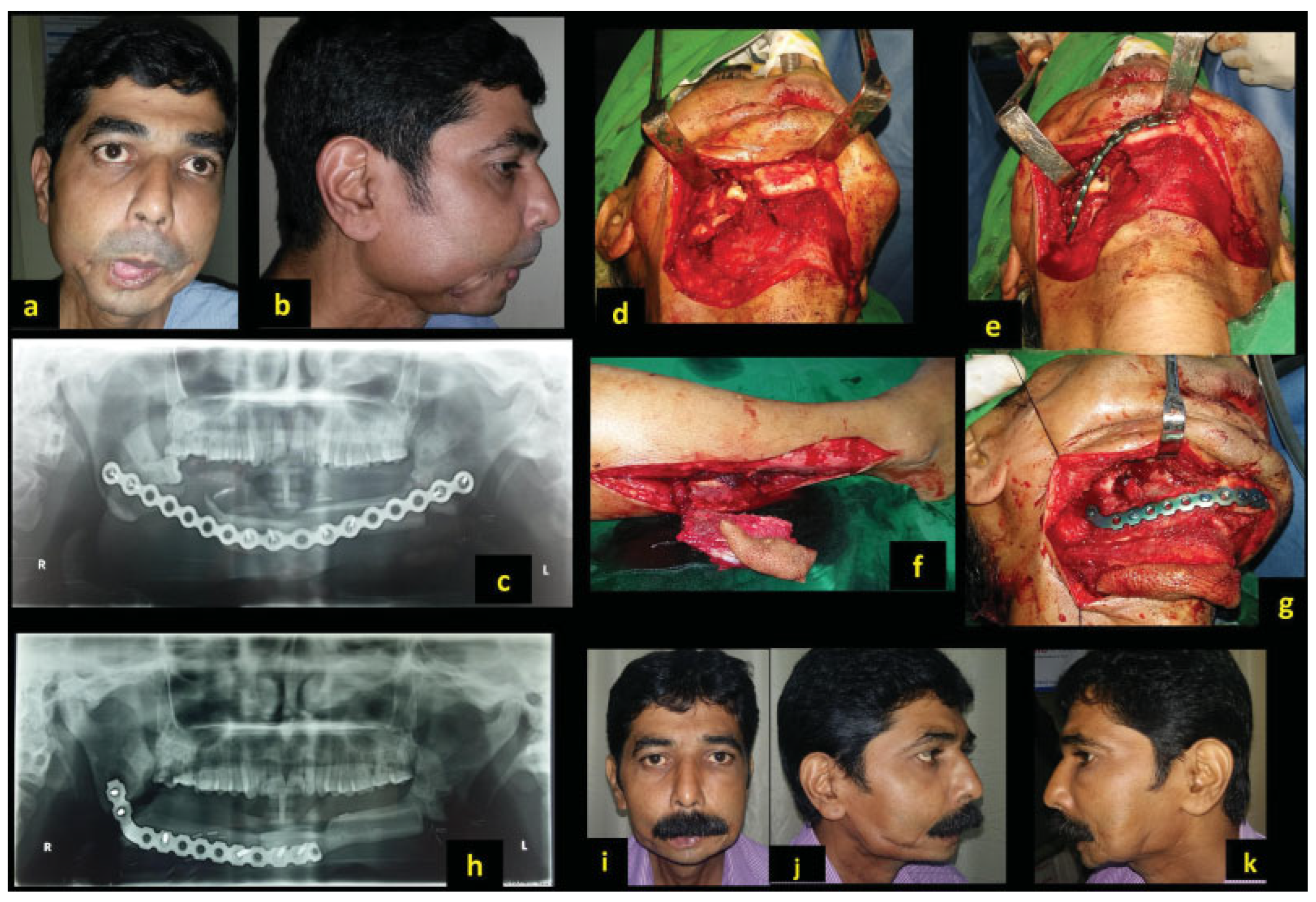 Cmtr 12 00039 g005 Cmtr 12 00039 g005