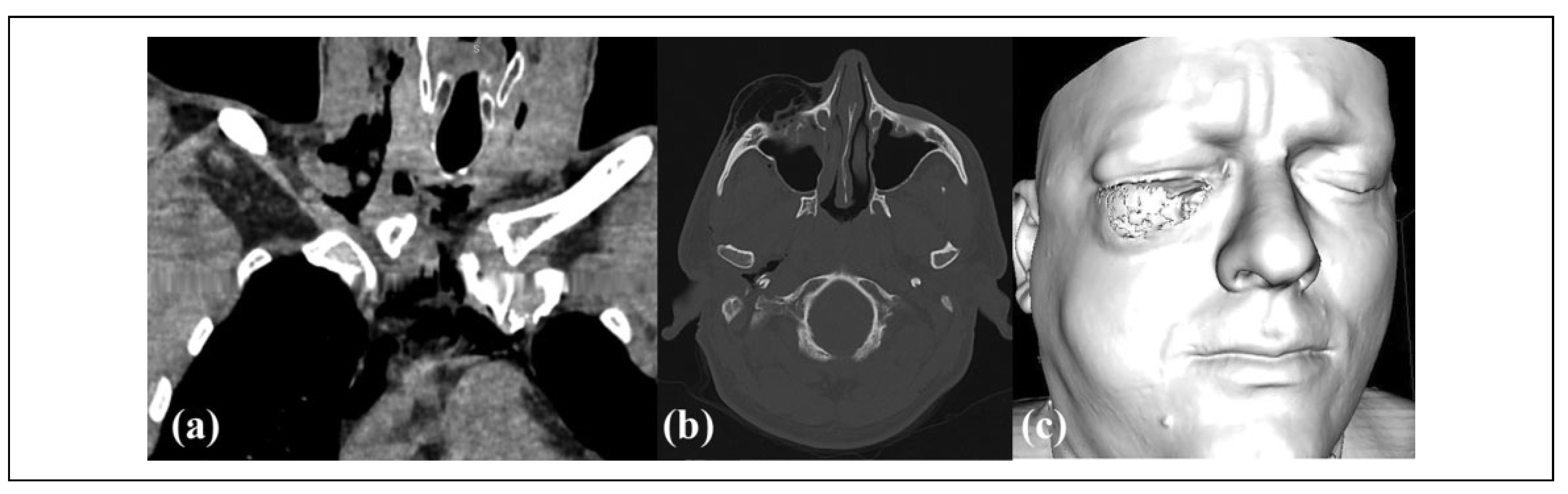 Cmtr 15 00012 g002 Cmtr 15 00012 g002