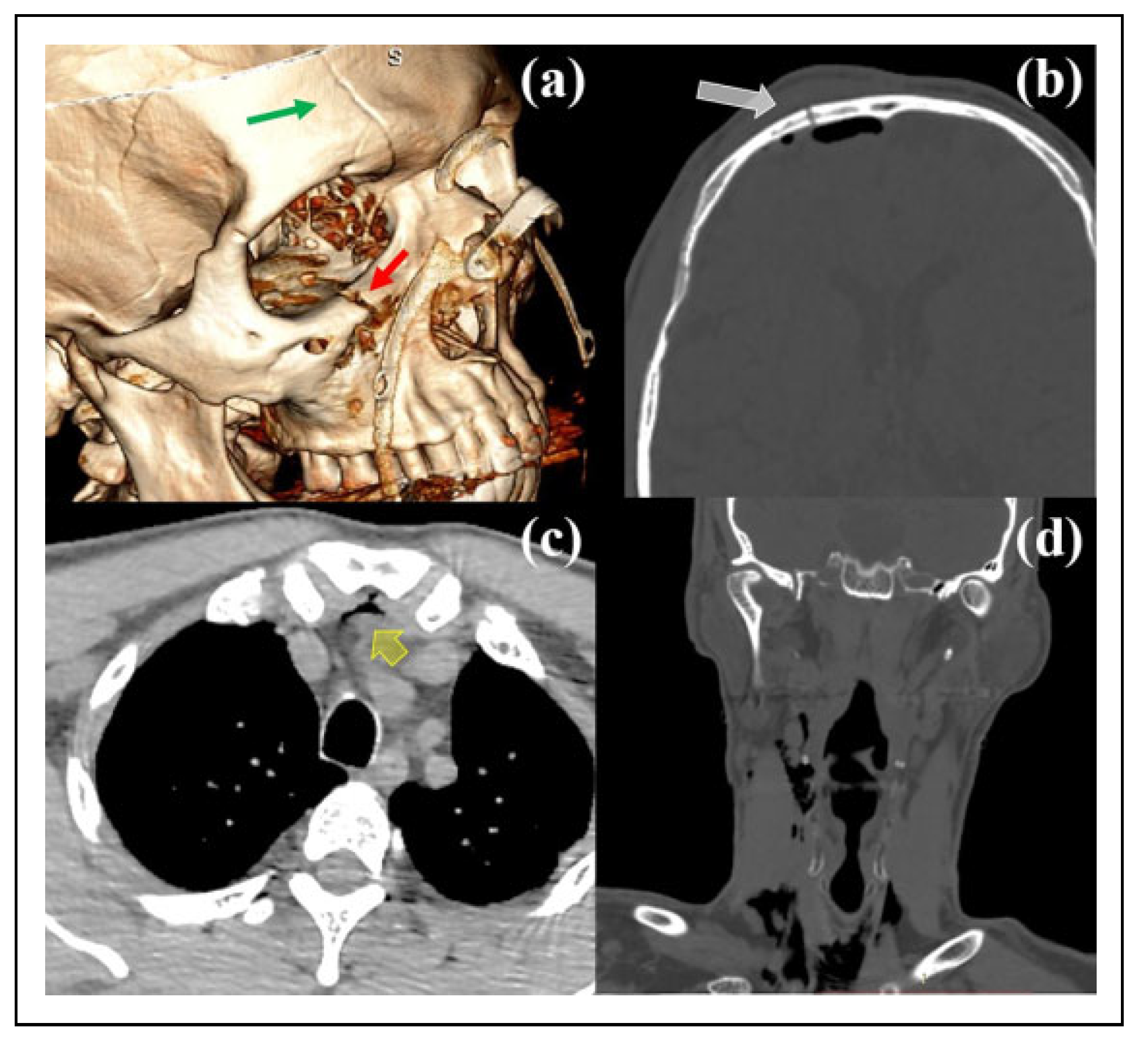 Cmtr 15 00012 g003 Cmtr 15 00012 g003
