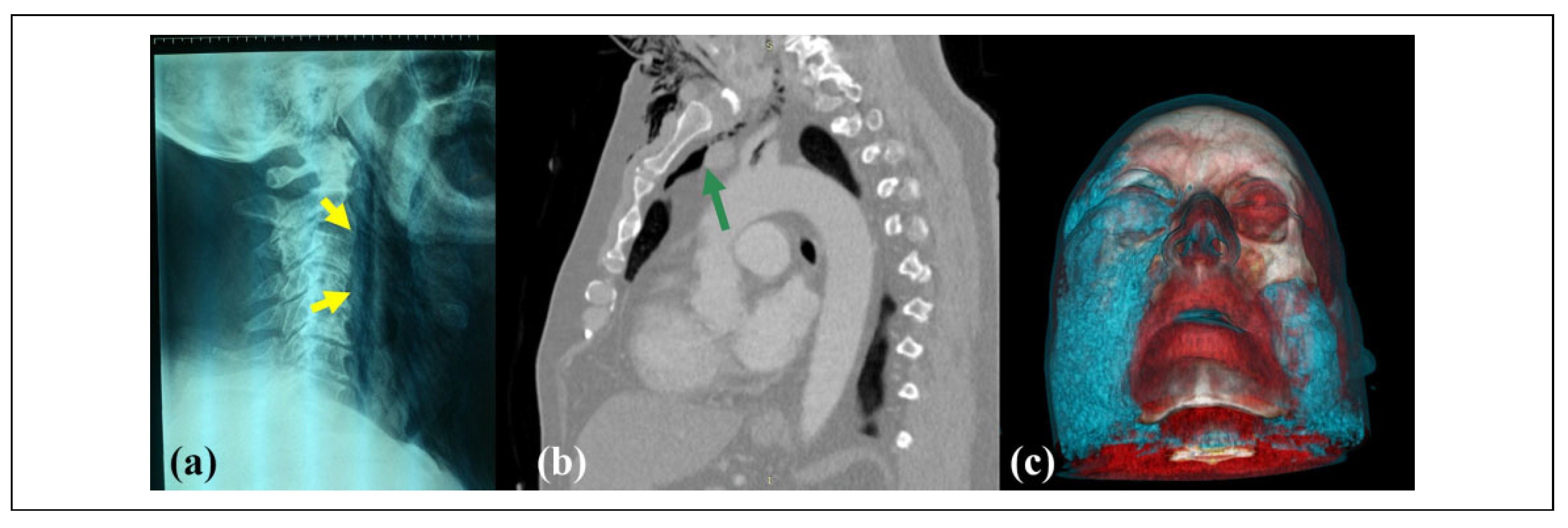 Cmtr 15 00012 g004 Cmtr 15 00012 g004