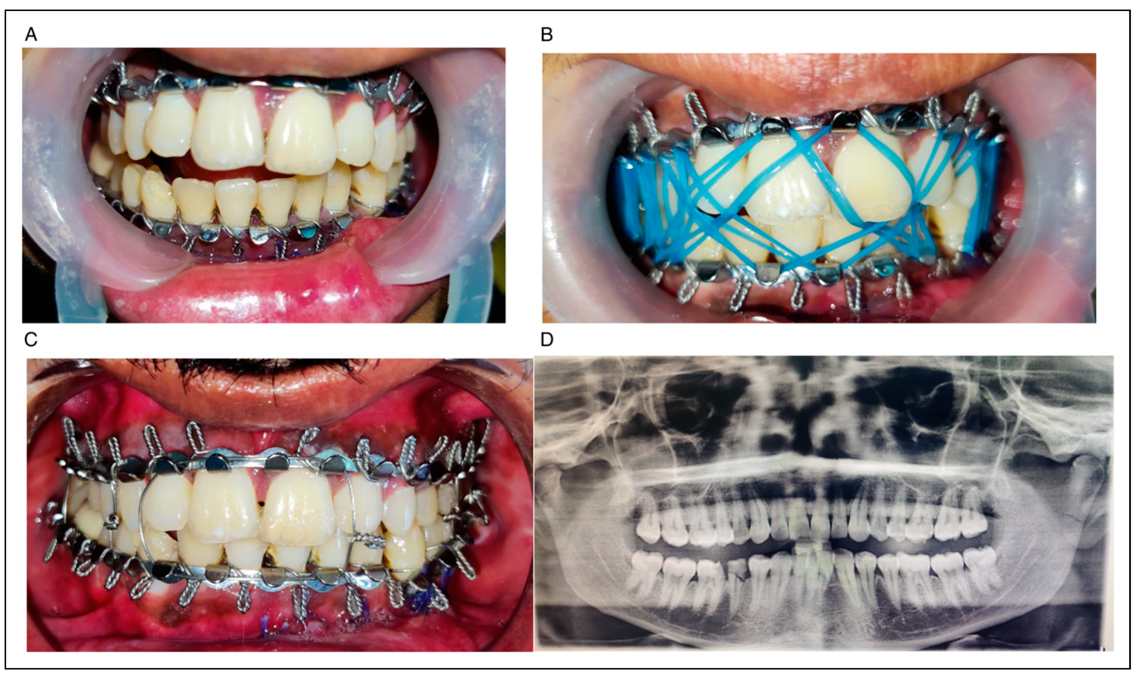 Cmtr 17 00004 g019 Cmtr 17 00004 g019