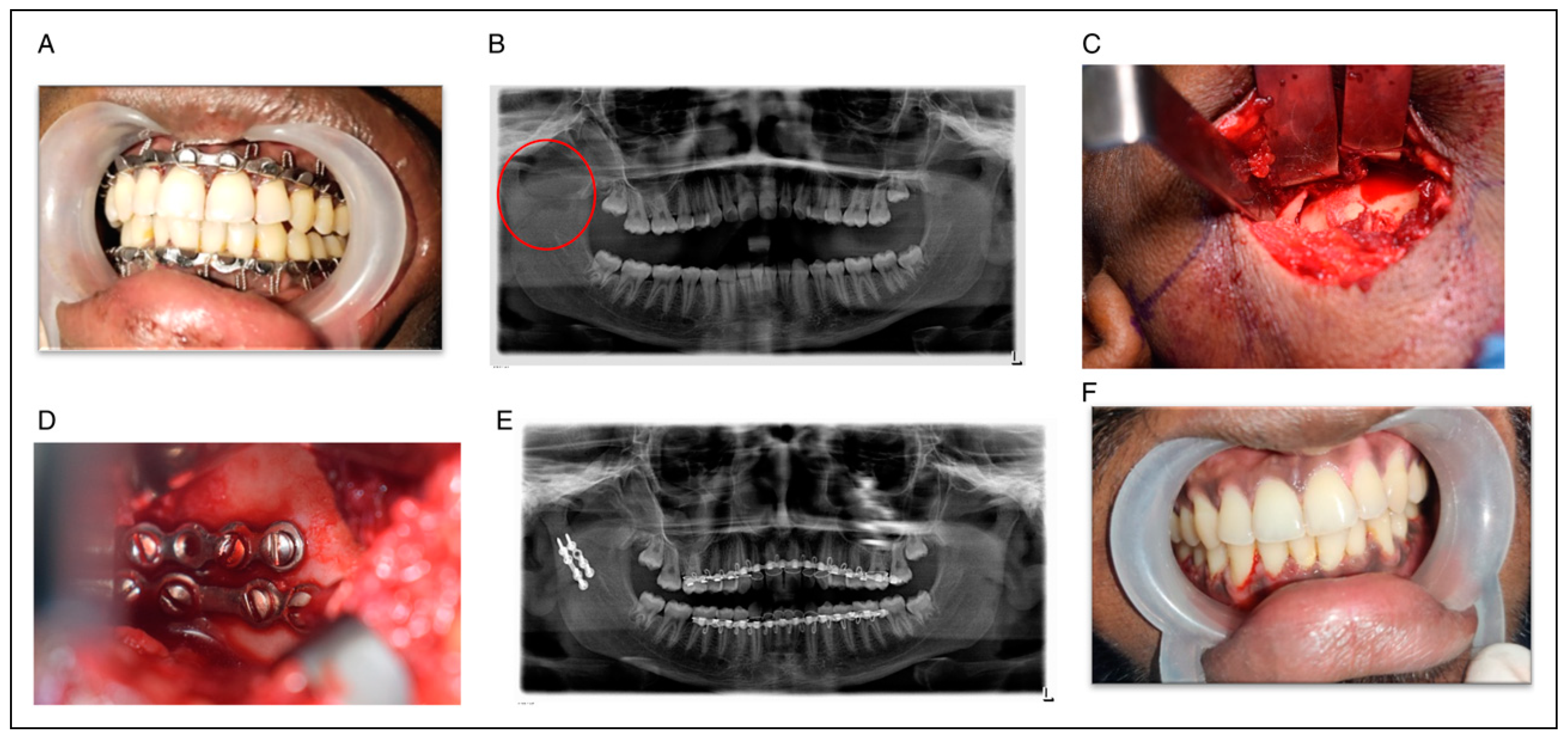 Cmtr 17 00004 g020 Cmtr 17 00004 g020