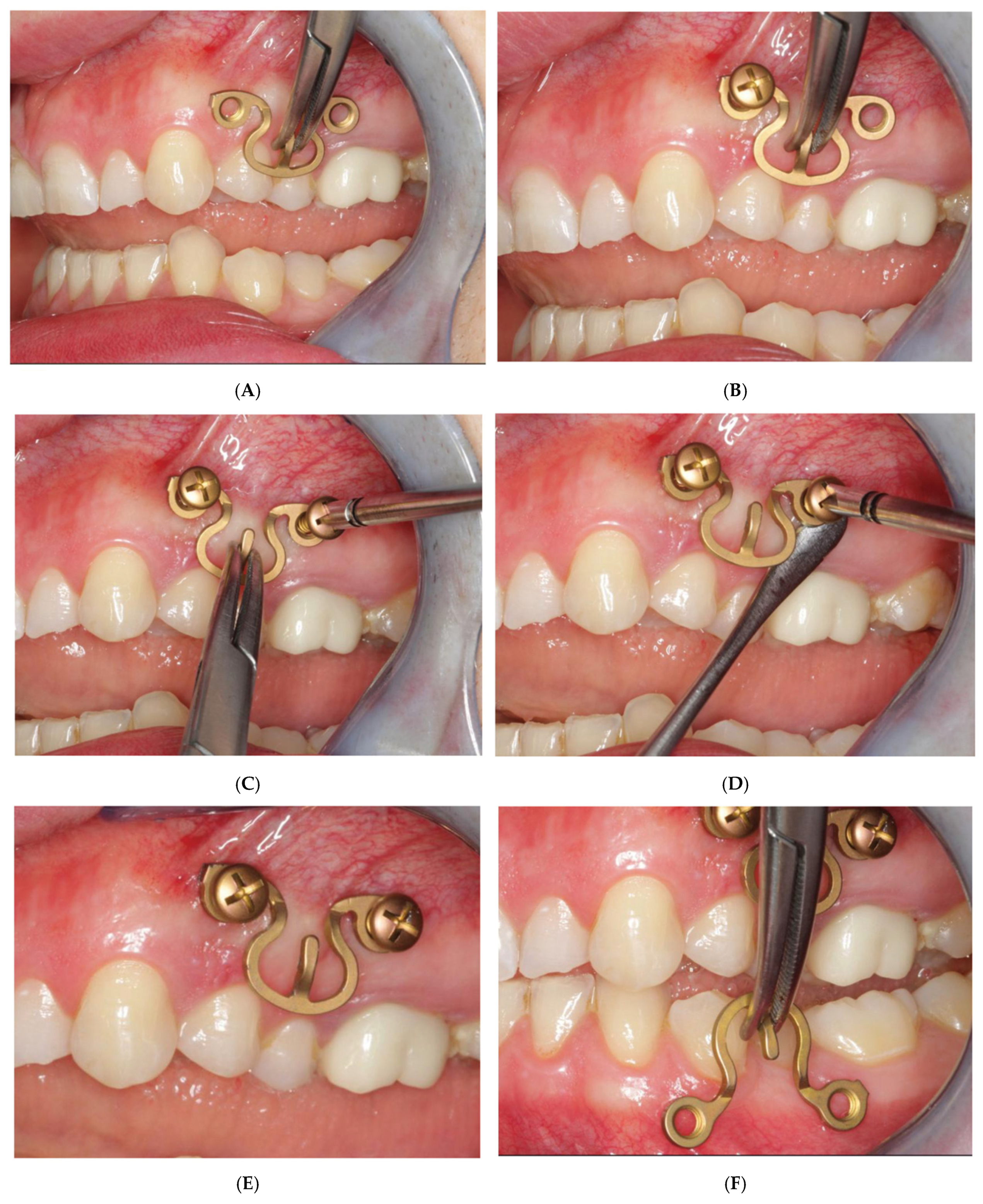 Cmtr 18 00032 g015a Cmtr 18 00032 g015a