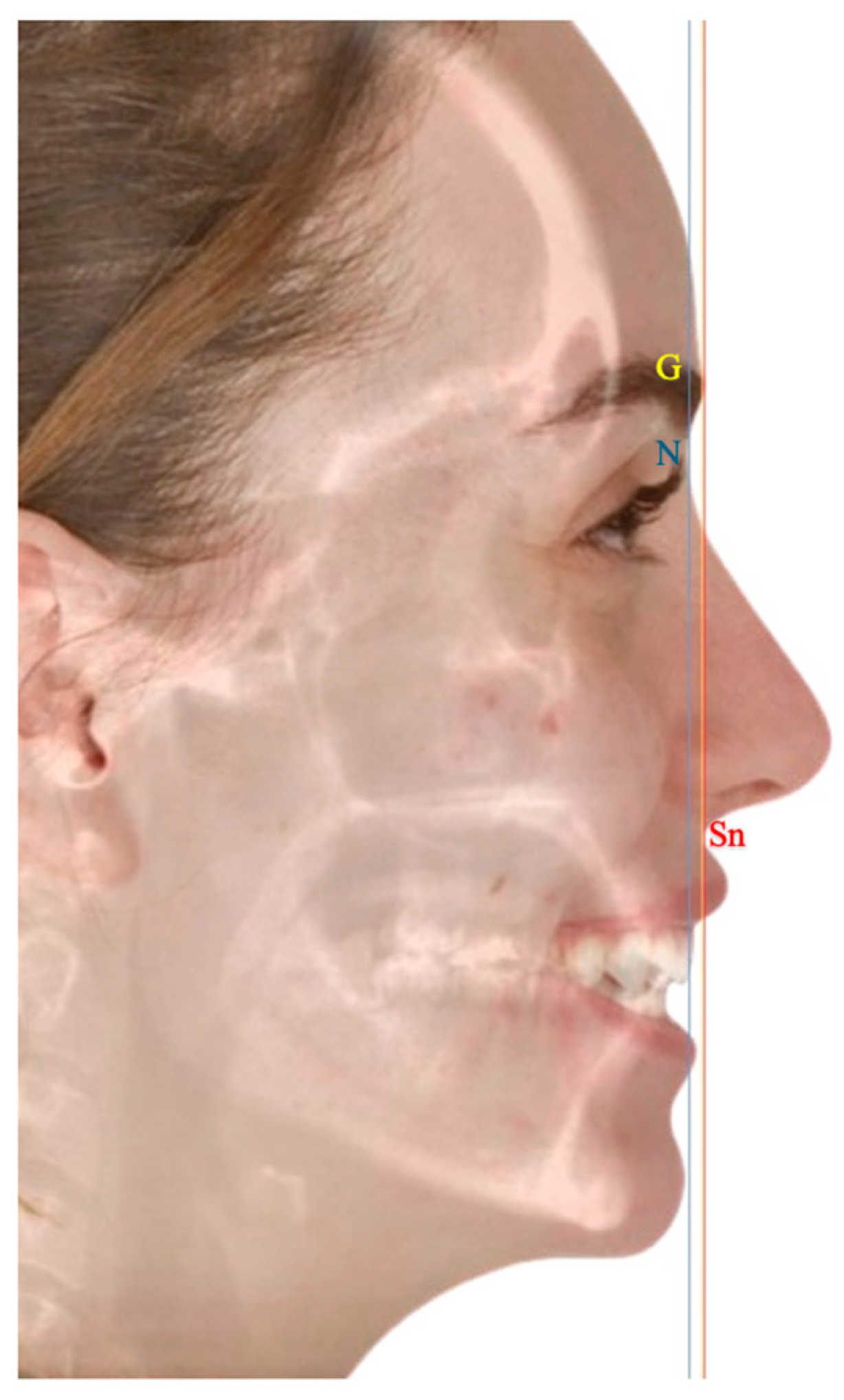 Cmtr 18 00045 g005 Cmtr 18 00045 g005