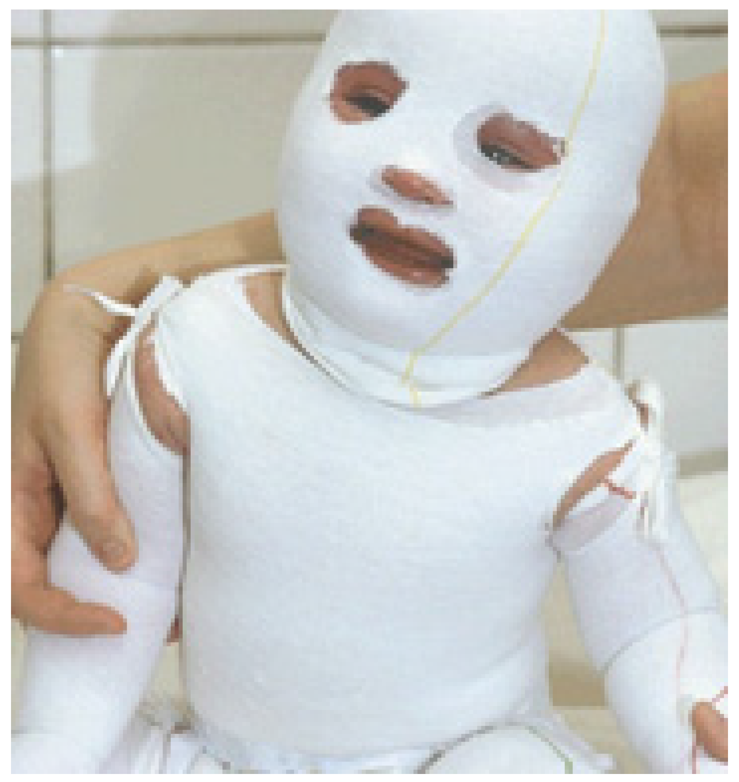 Coatings Free FullText Functionalized Textile Based Therapy for