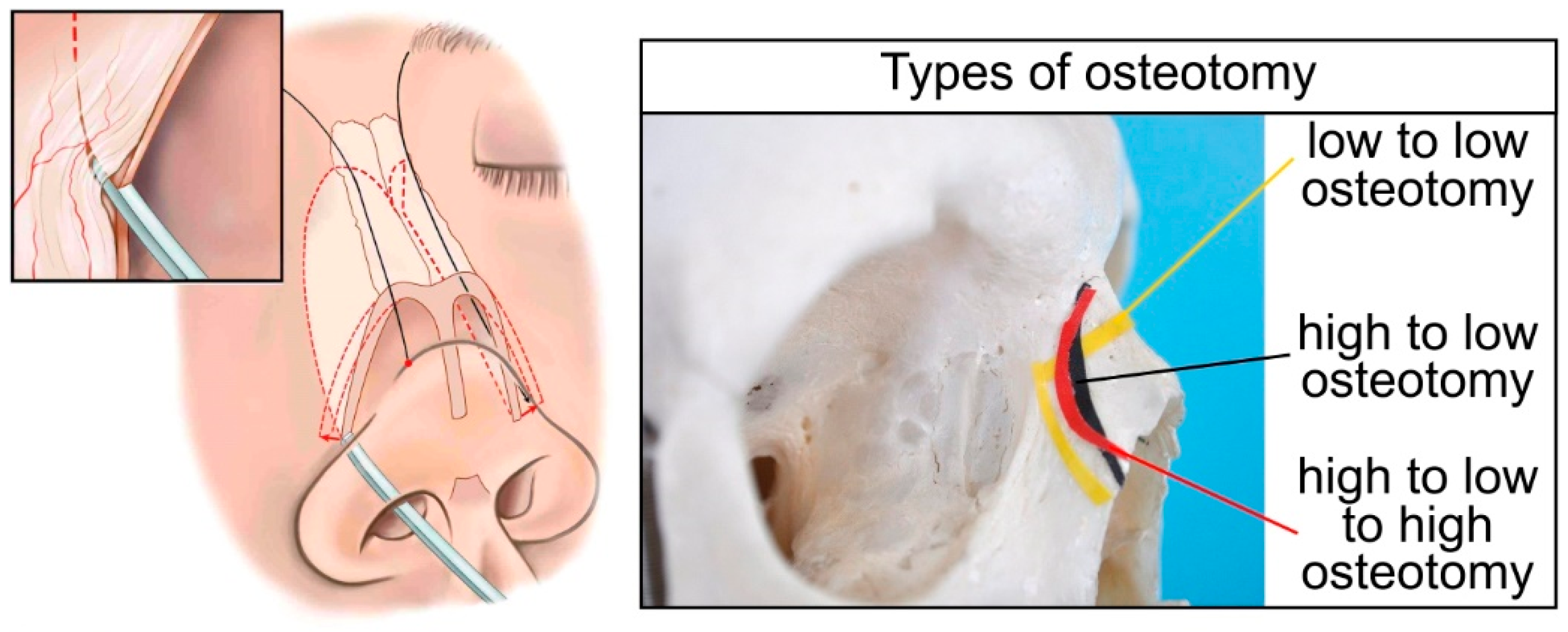 Coatings 09 00855 g001