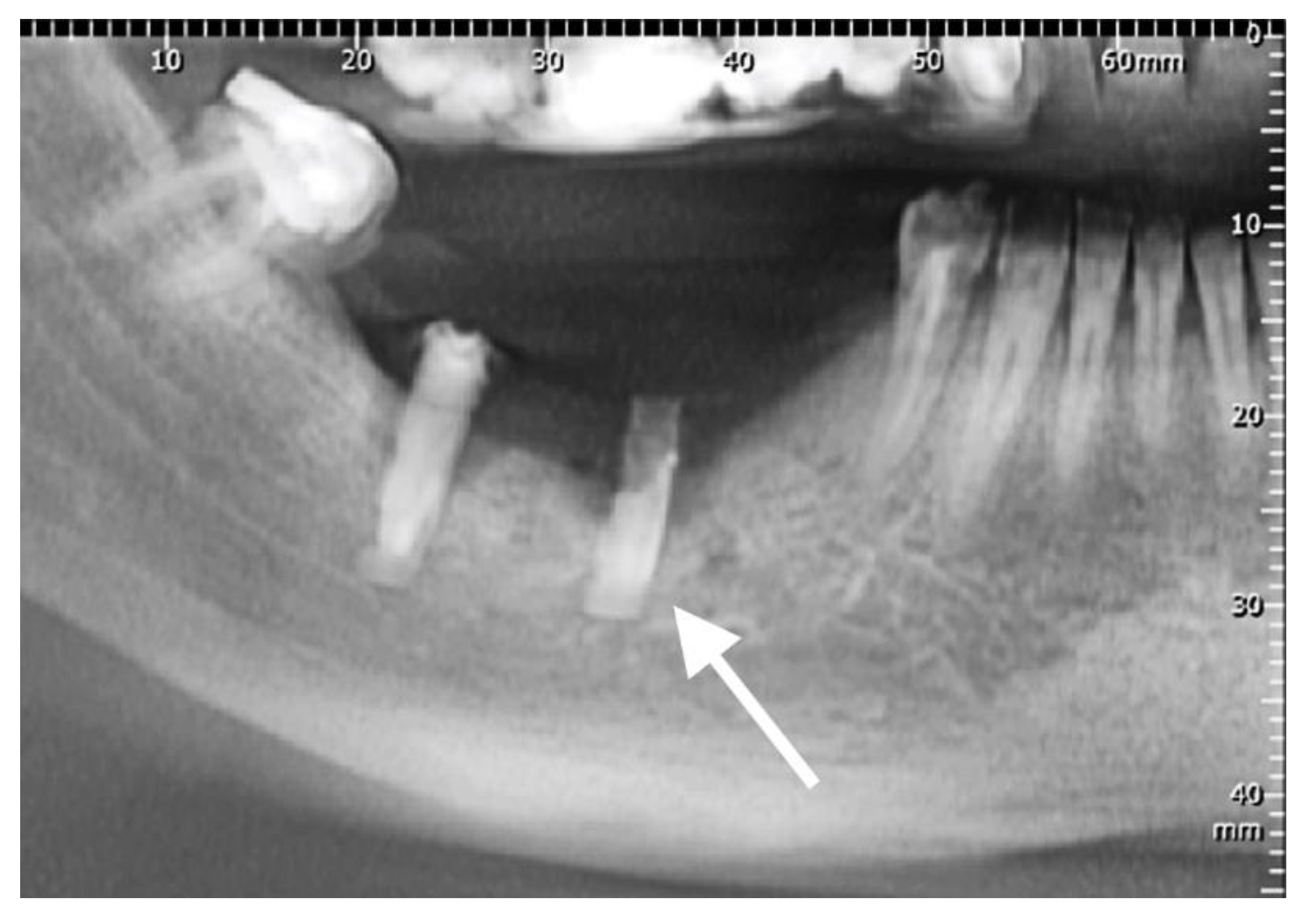 Coatings 10 00209 g004
