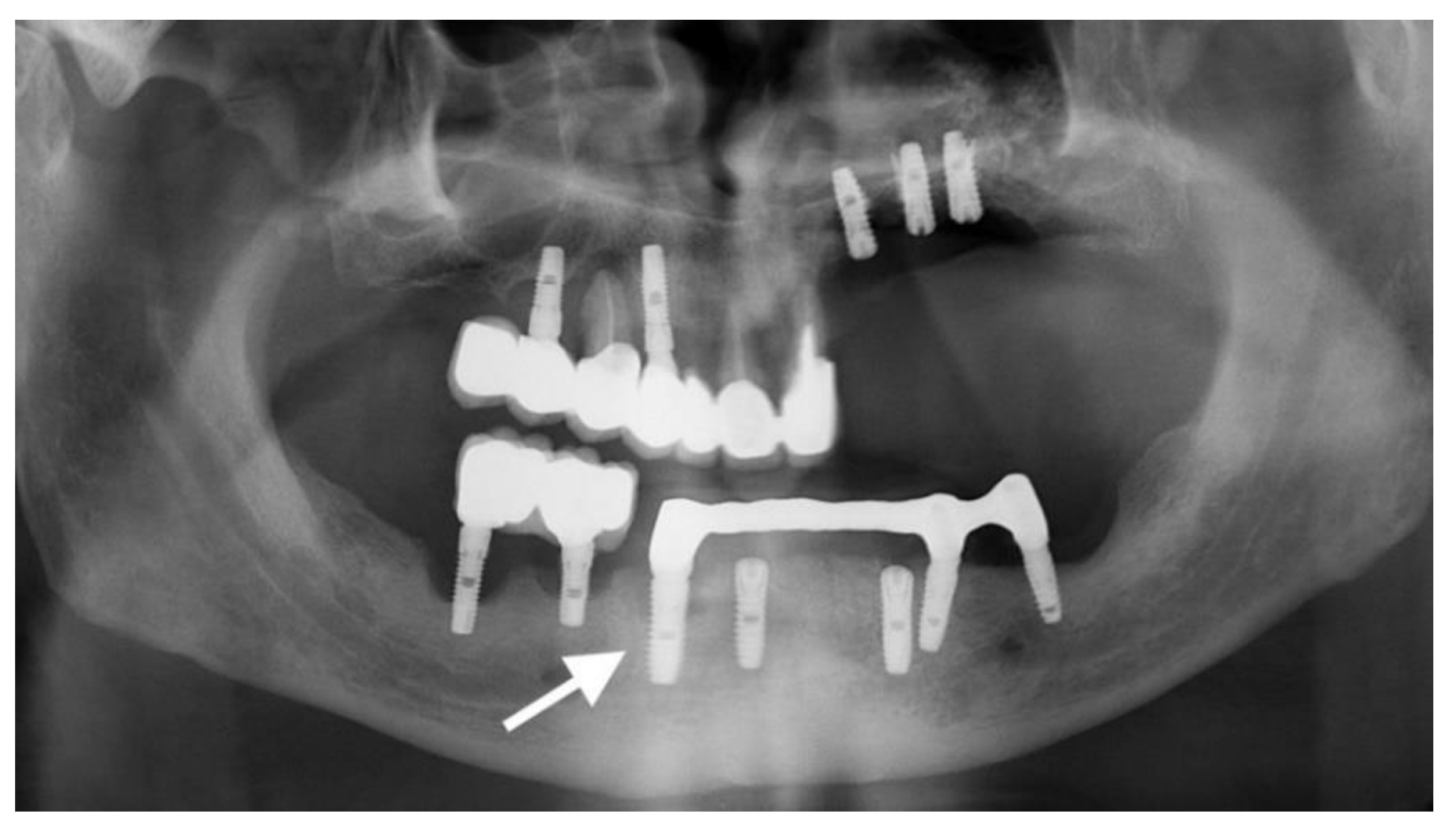 Coatings 10 00209 g005