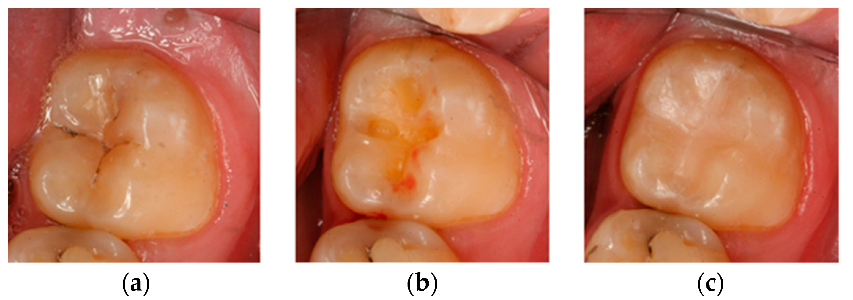 Coatings 10 00800 g003