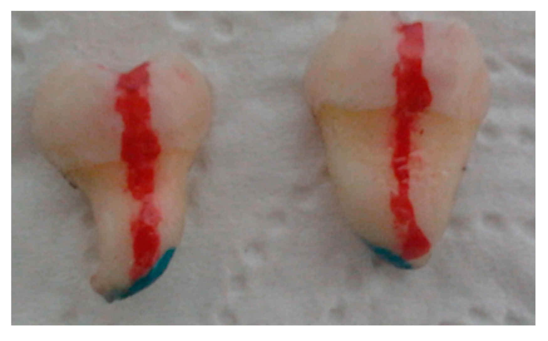 Coatings 10 00915 g001