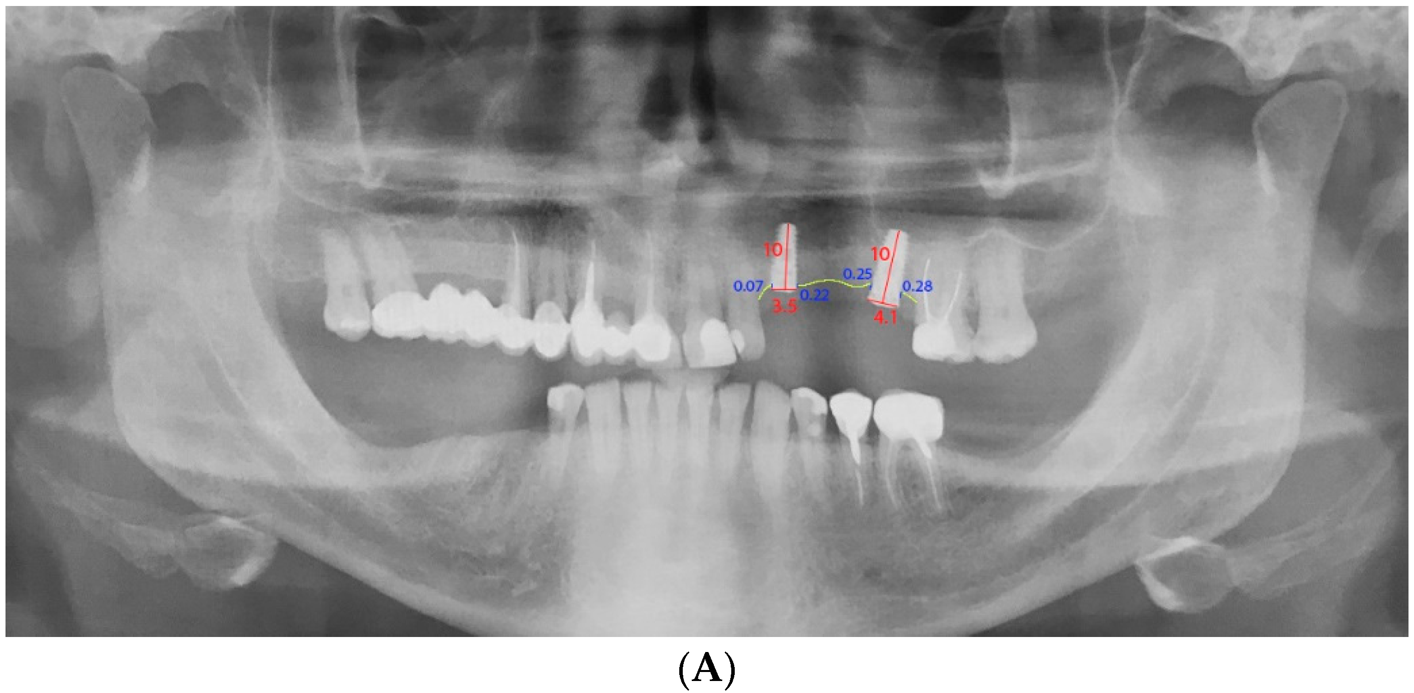 Coatings 10 01044 g002a