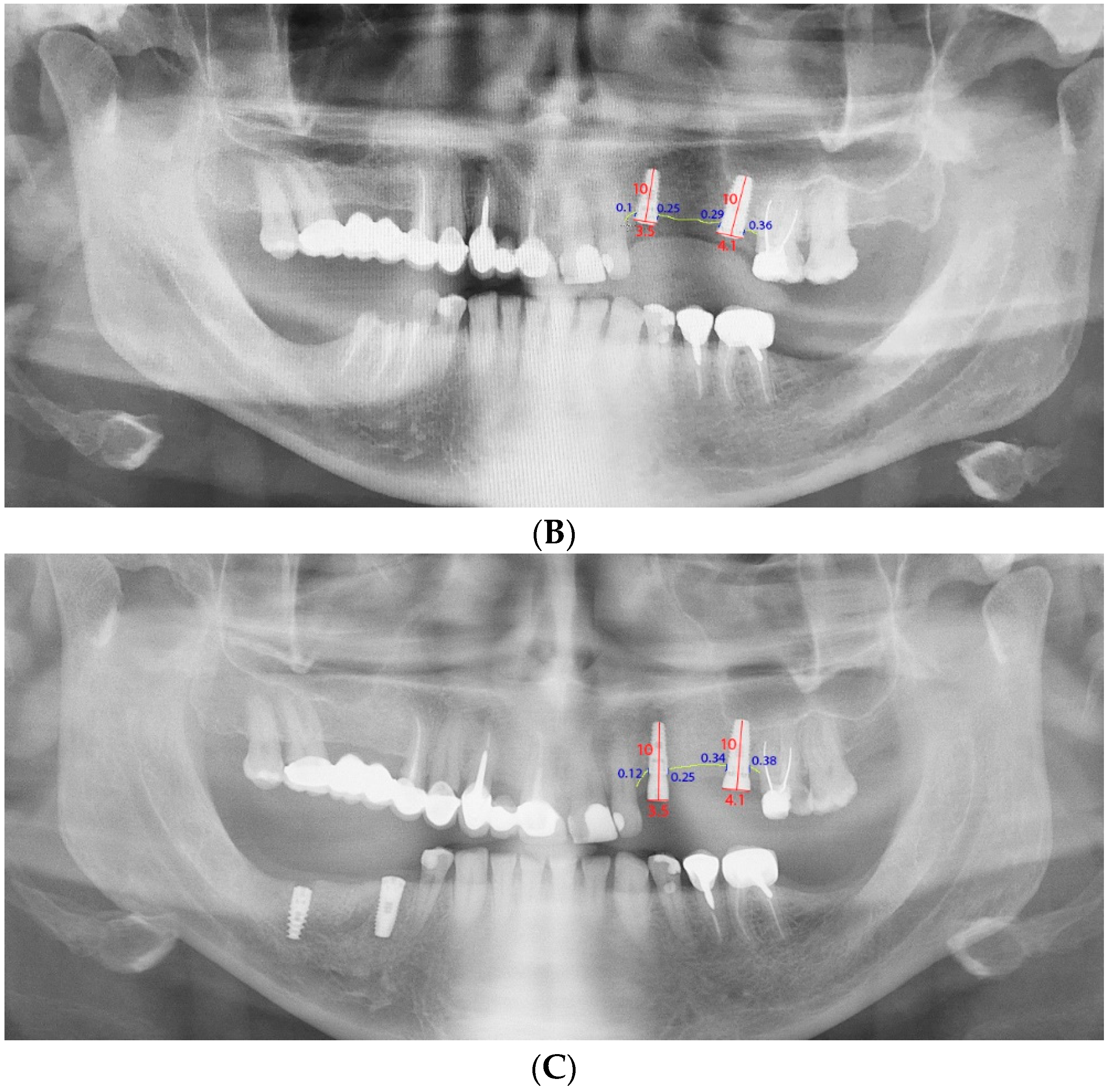 Coatings 10 01044 g002b