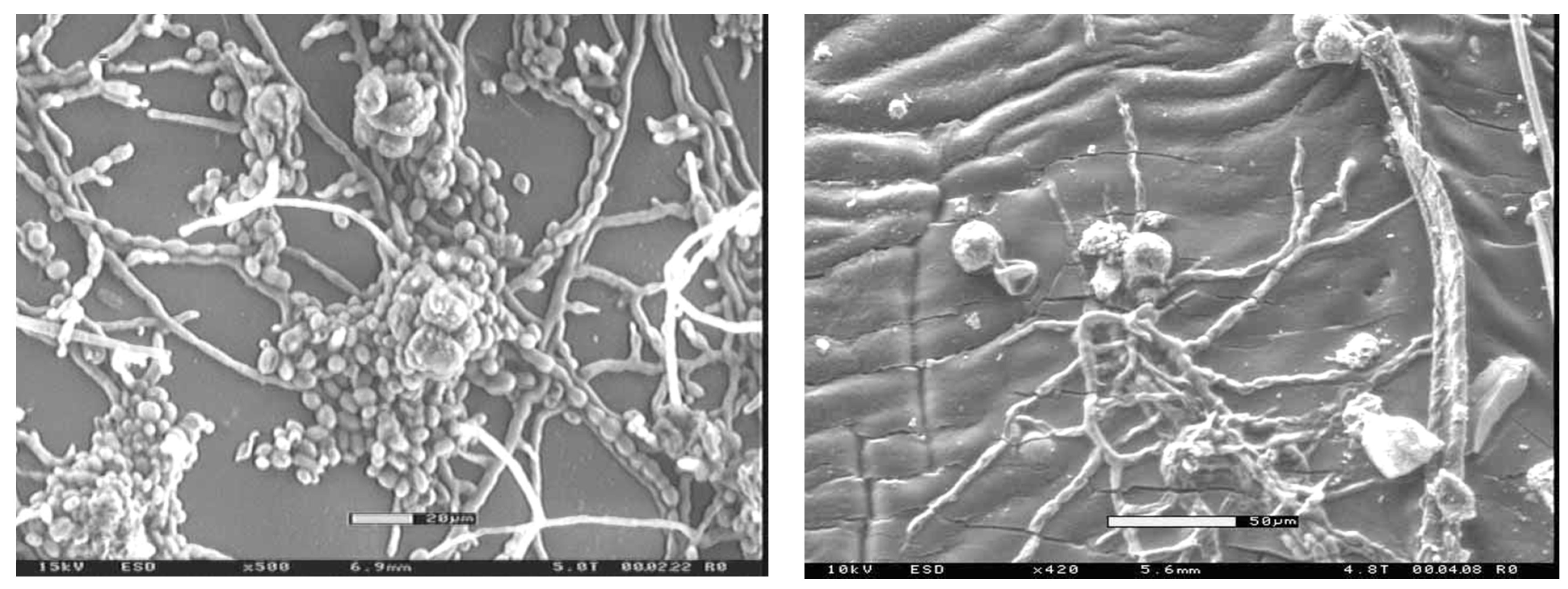 Coatings 10 01210 g003