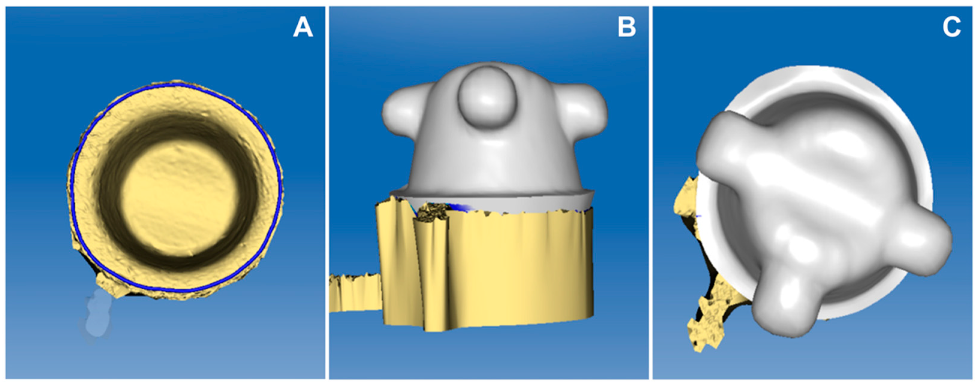 Coatings 11 00315 g003