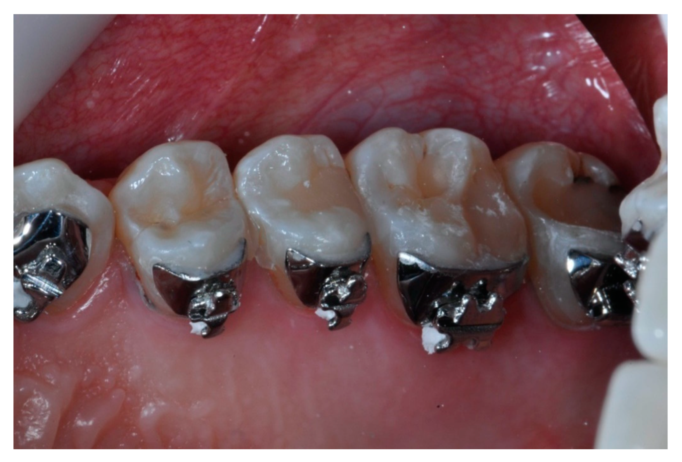 Coatings 11 00572 g003 Coatings 11 00572 g003