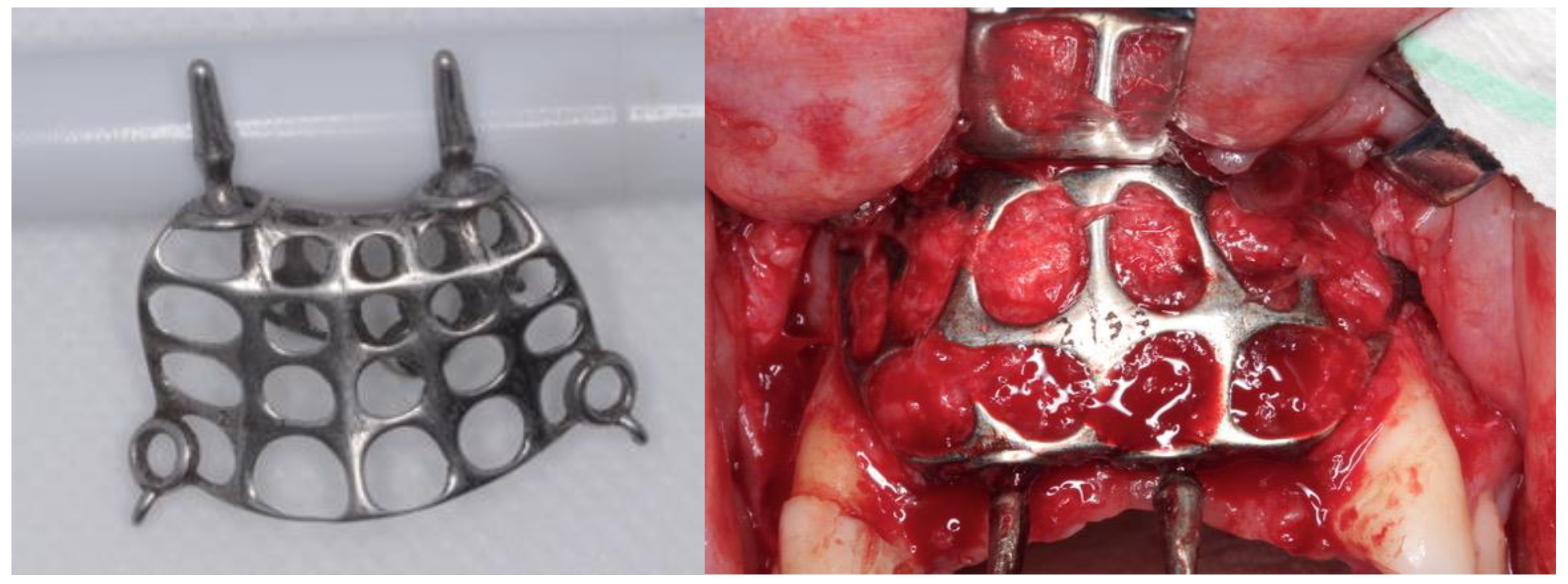 Coatings 12 00154 g001